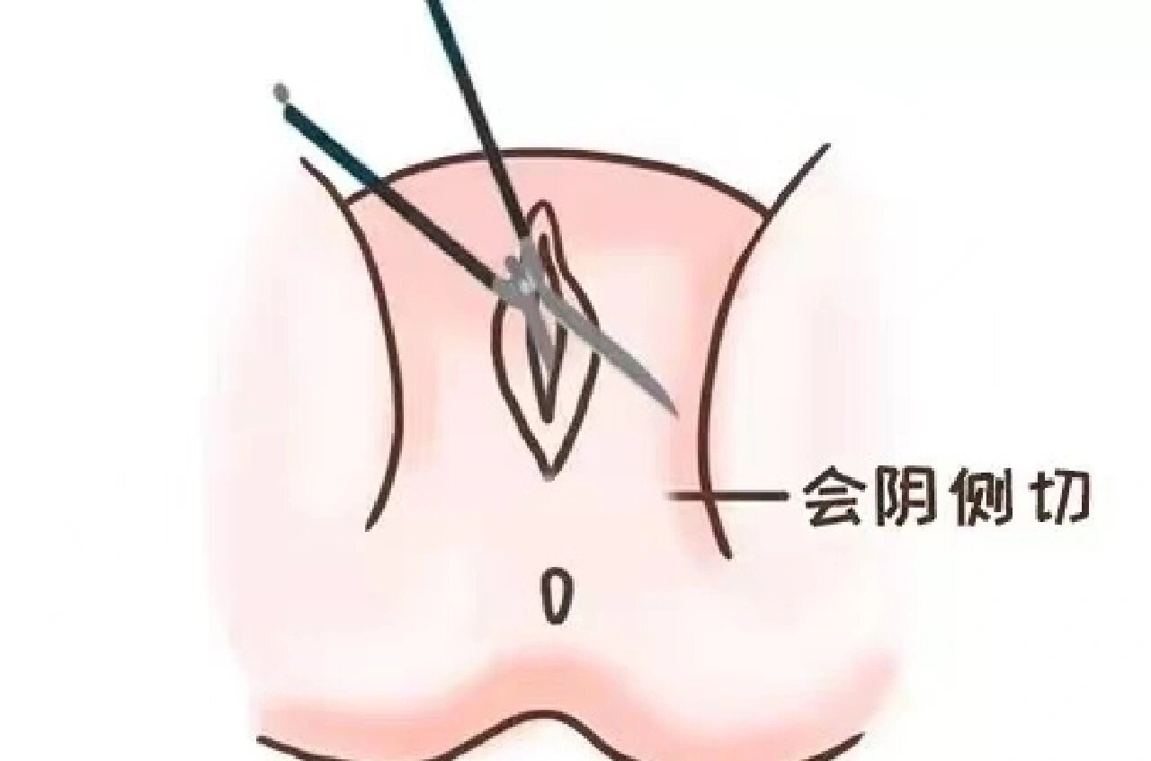 侧切图片真实图片