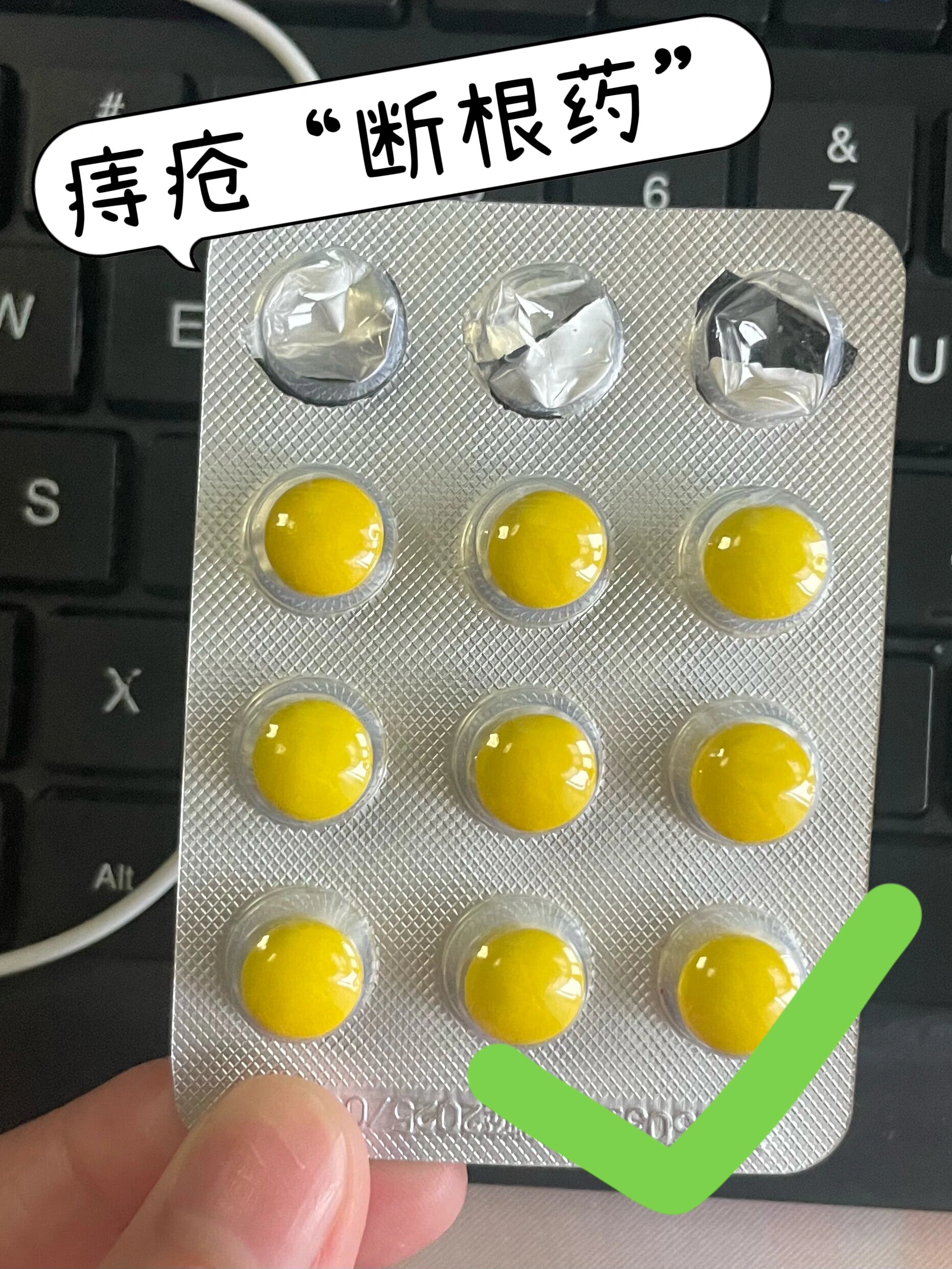  br>- br>【1】痔疮肿痛——断根 br>(马甲膏) br>威力:缓解痔疮肿痛