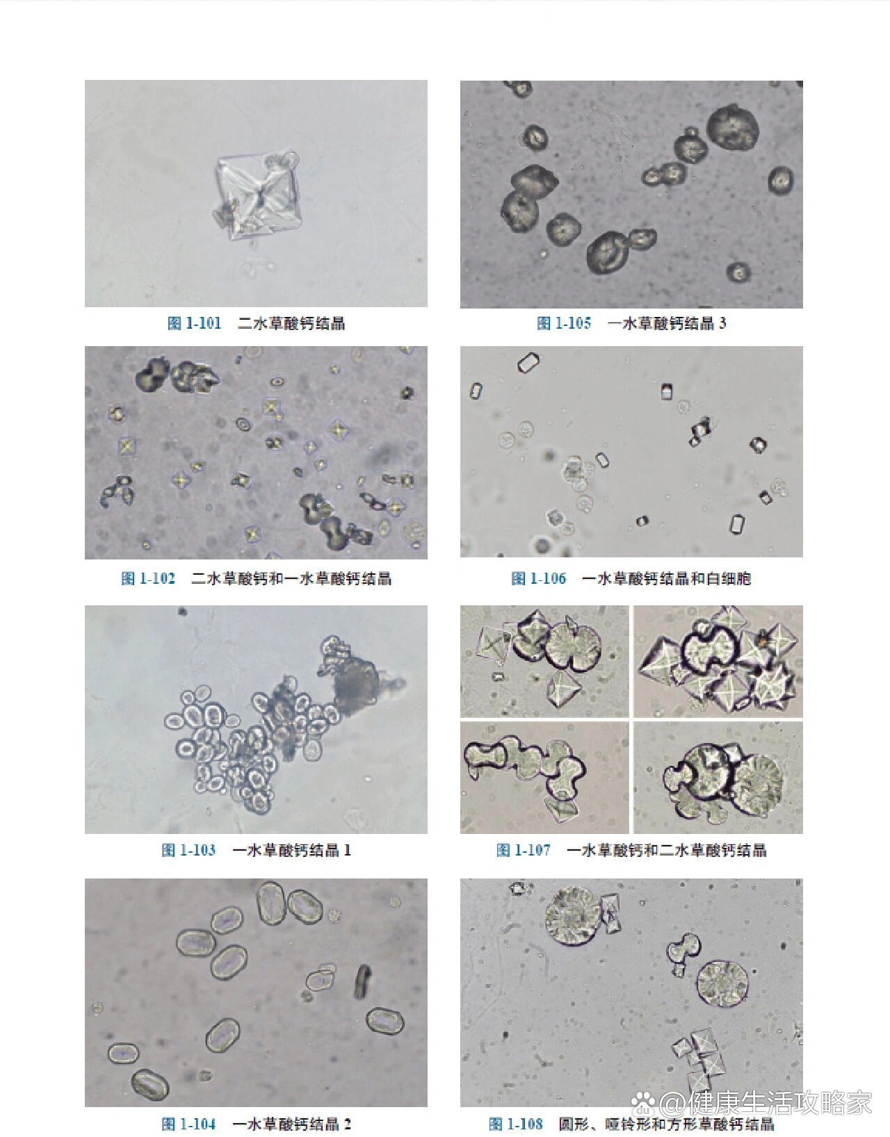 草酸钙结晶——超全高清体液图谱