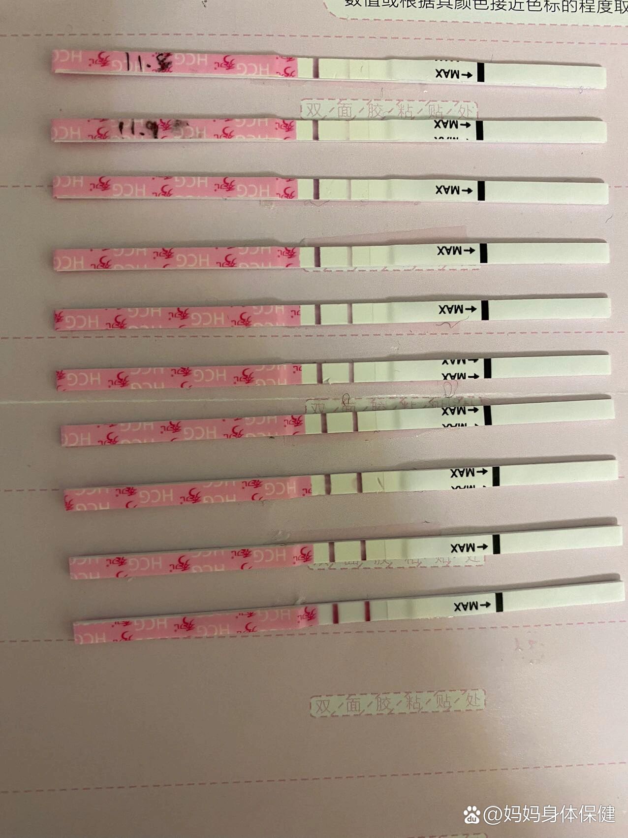双侧输卵管通而不畅,后续好孕啦