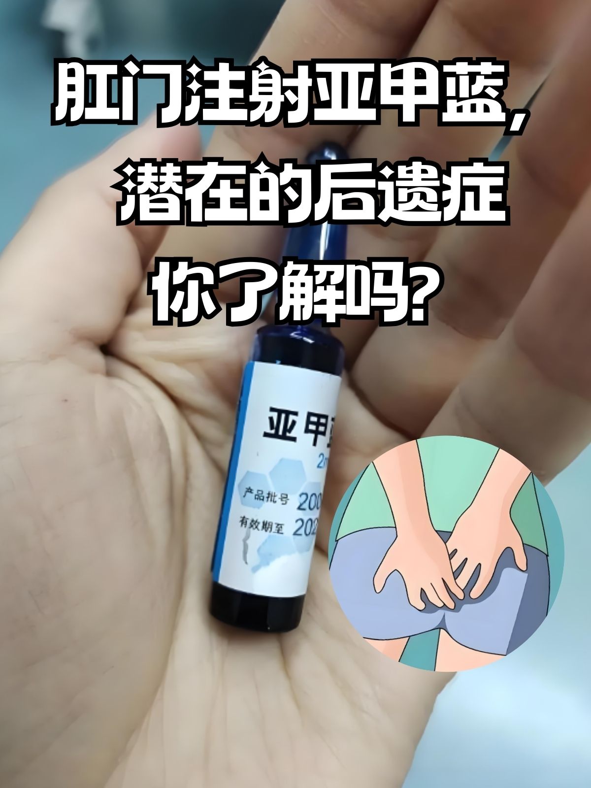 肛门注射亚甲蓝,潜在的后遗症你了解吗?