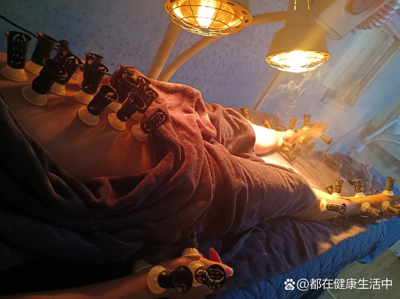 好消息,十五年的鼻窦炎用艾灸痊愈了