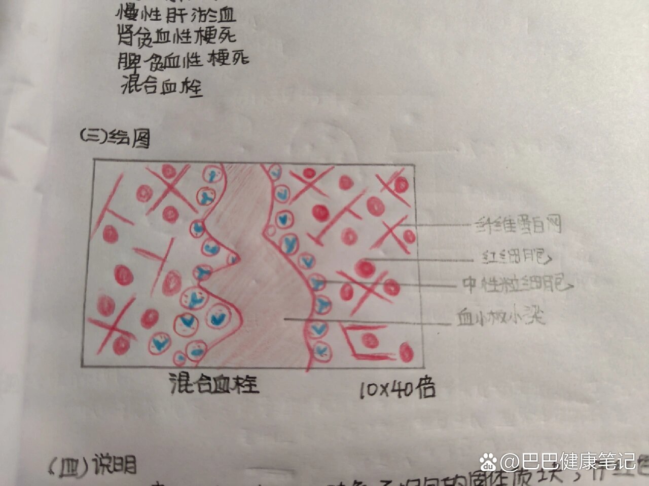 病理实验画图——混合血栓