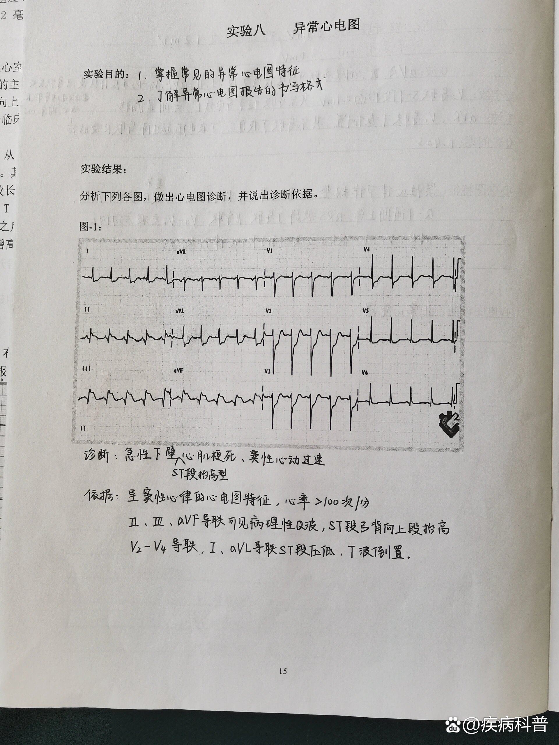 心电图实验报告图片