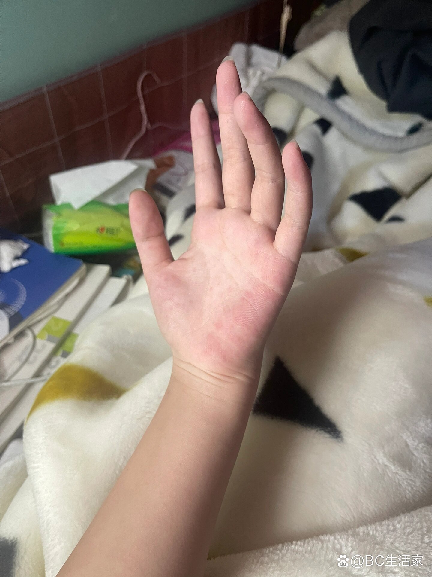 手心长红点点是为什么