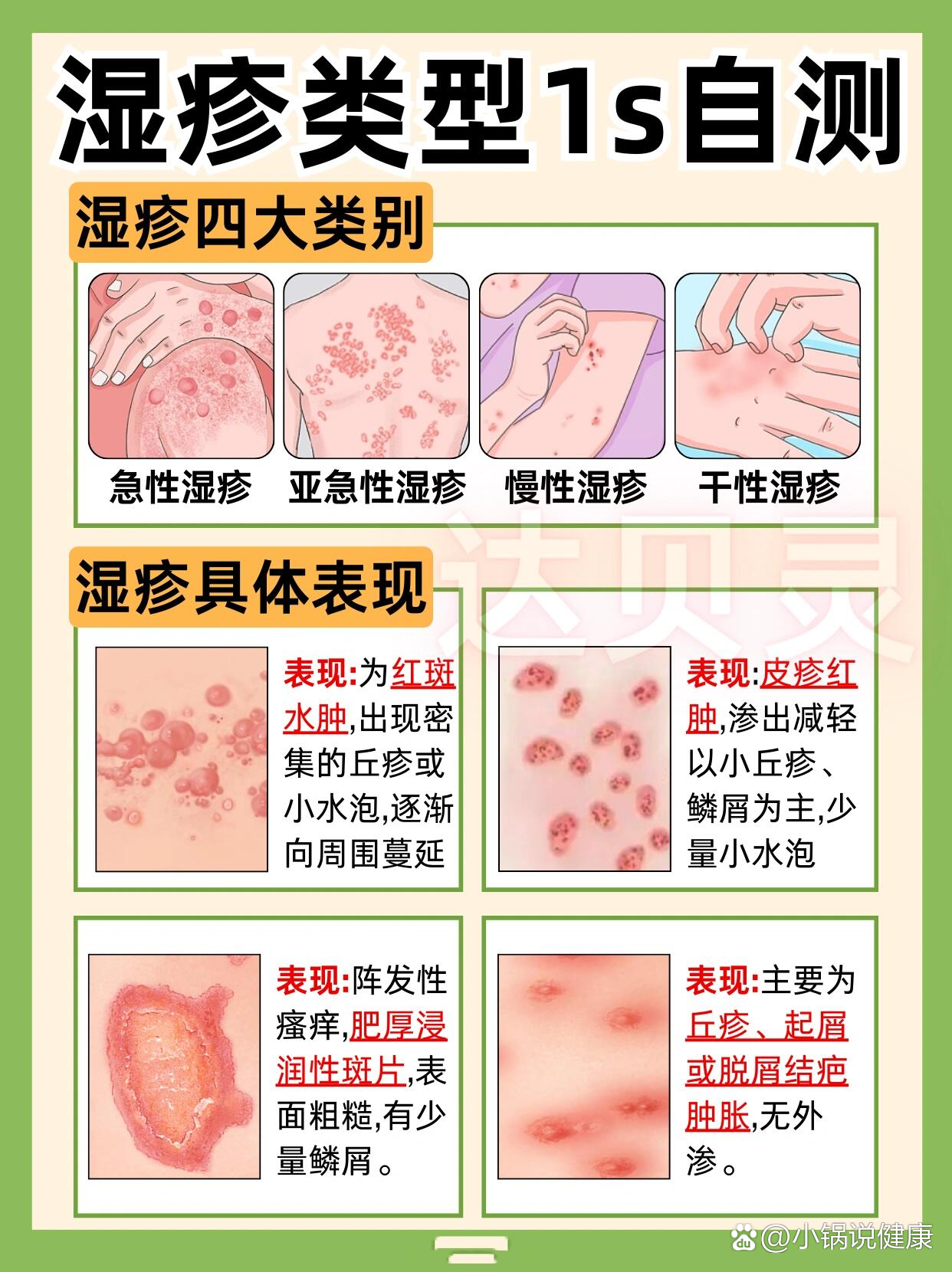 亚急性湿疹图片和症状图片