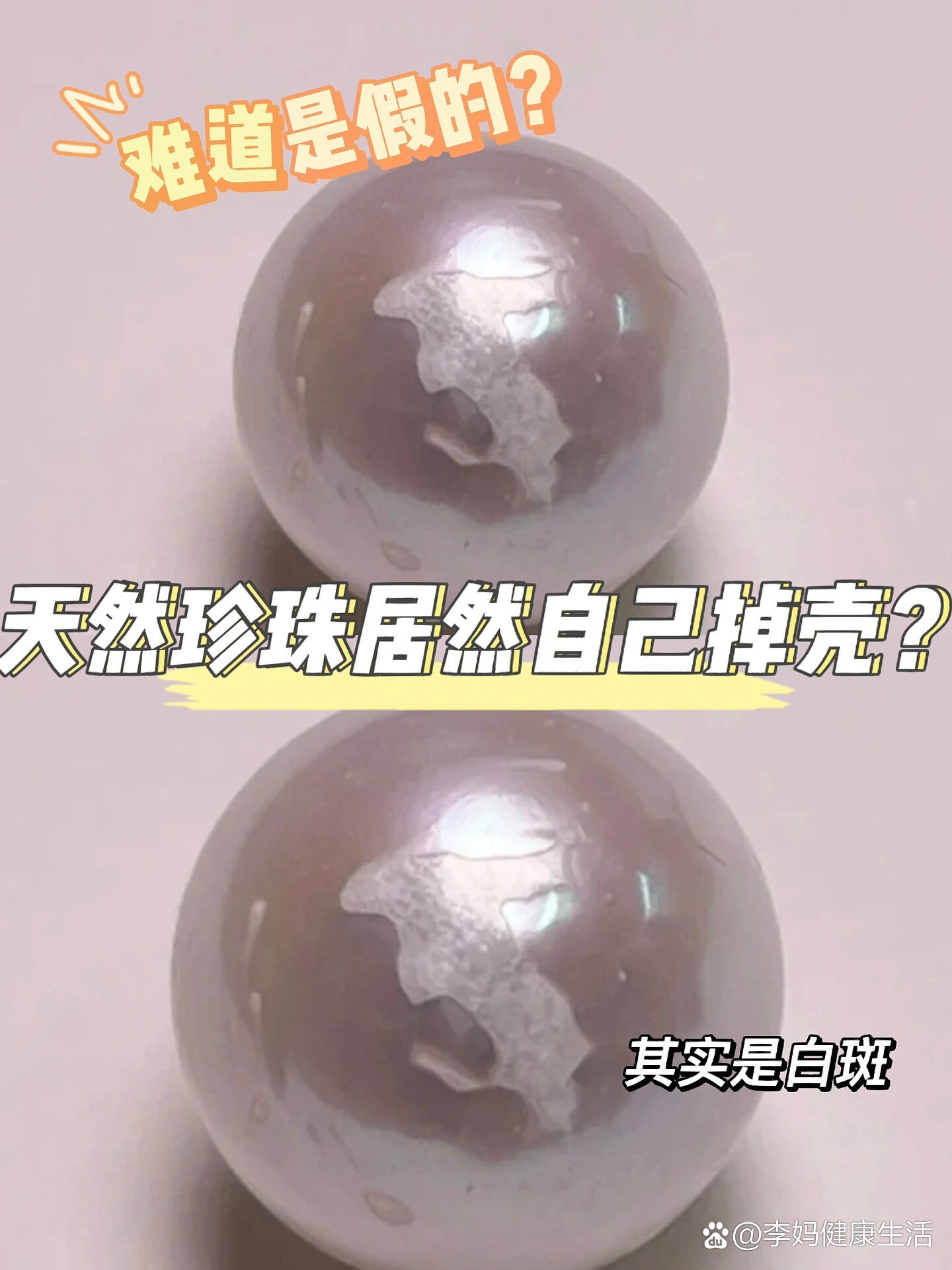 珍珠皱皮是真珍珠吗