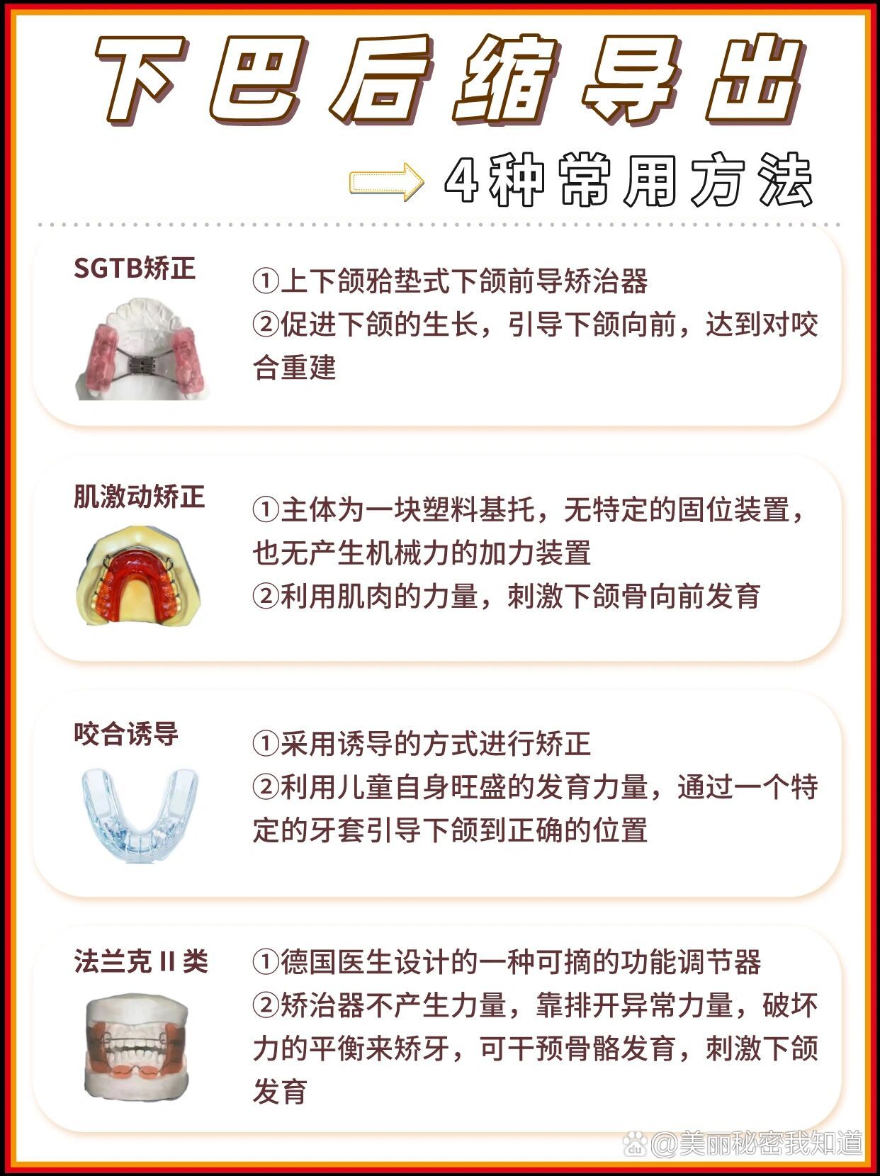 sgtb矫正 br>①可以矫正面部畸形的一款上下颌验垫式下颌前导矫治器 