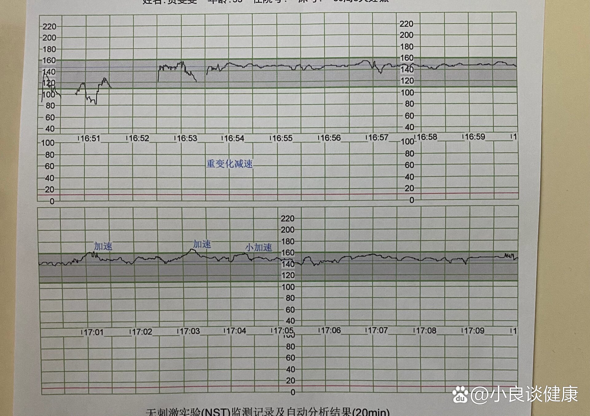 孕30周胎心位置图图片