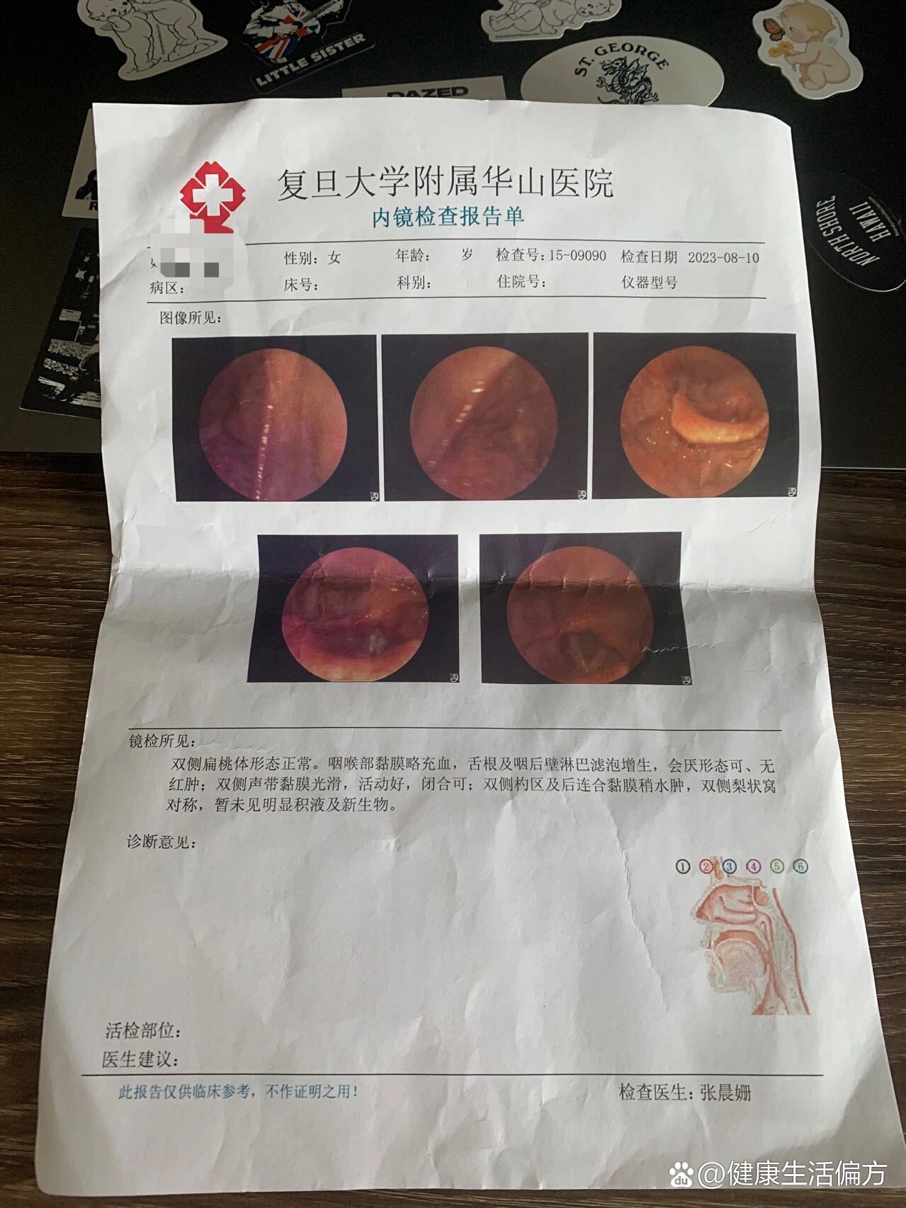大家都说做喉镜很难受,从鼻子里进入,我也是怕的要死,然而其实特别