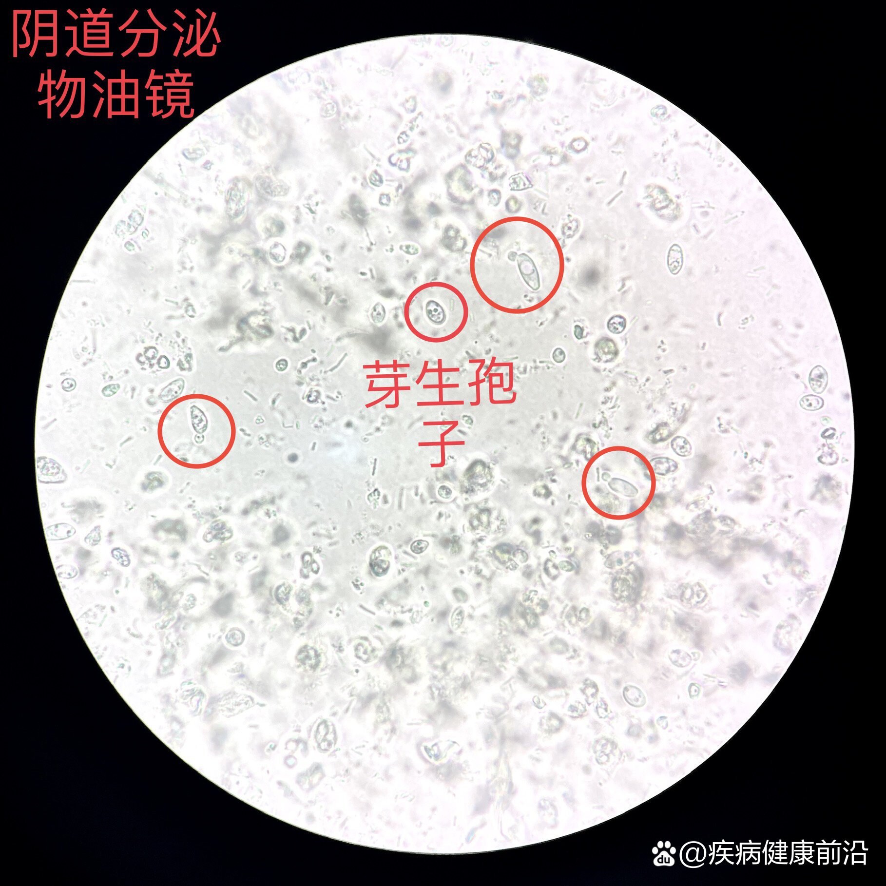 白带显微镜图解图片