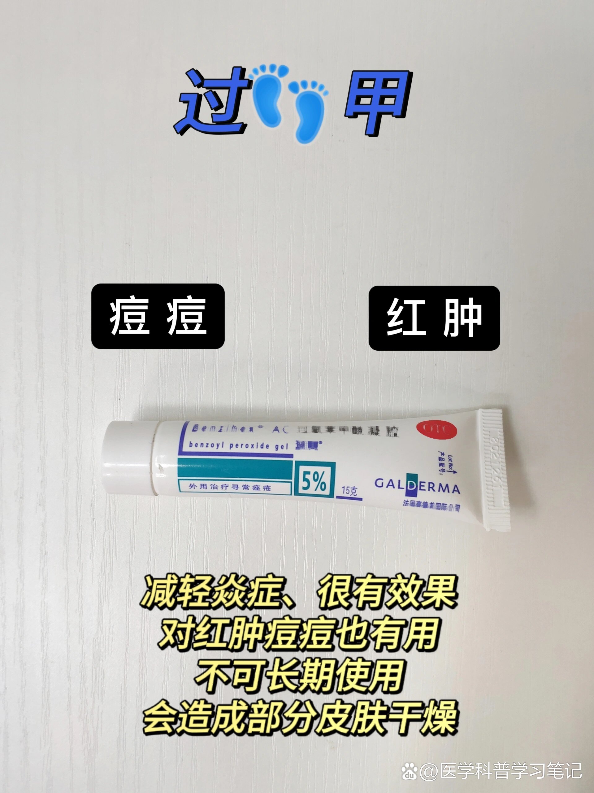 汗疱疹进7575好用的软膏都总结在这里了