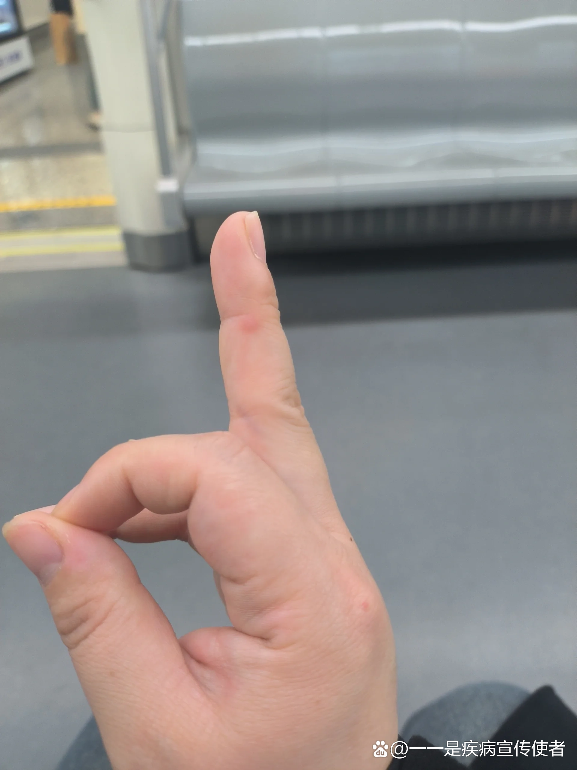 为什么突然硬不起是怎么回事(为什么突然硬不起是怎么回事吃什么药)