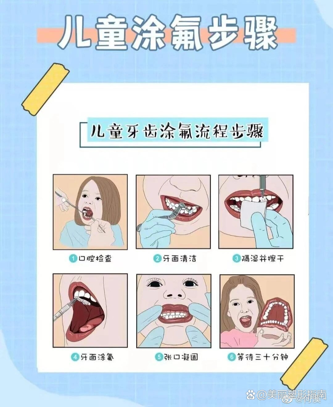 涂氟到底有没有必要会不会交成智商税?