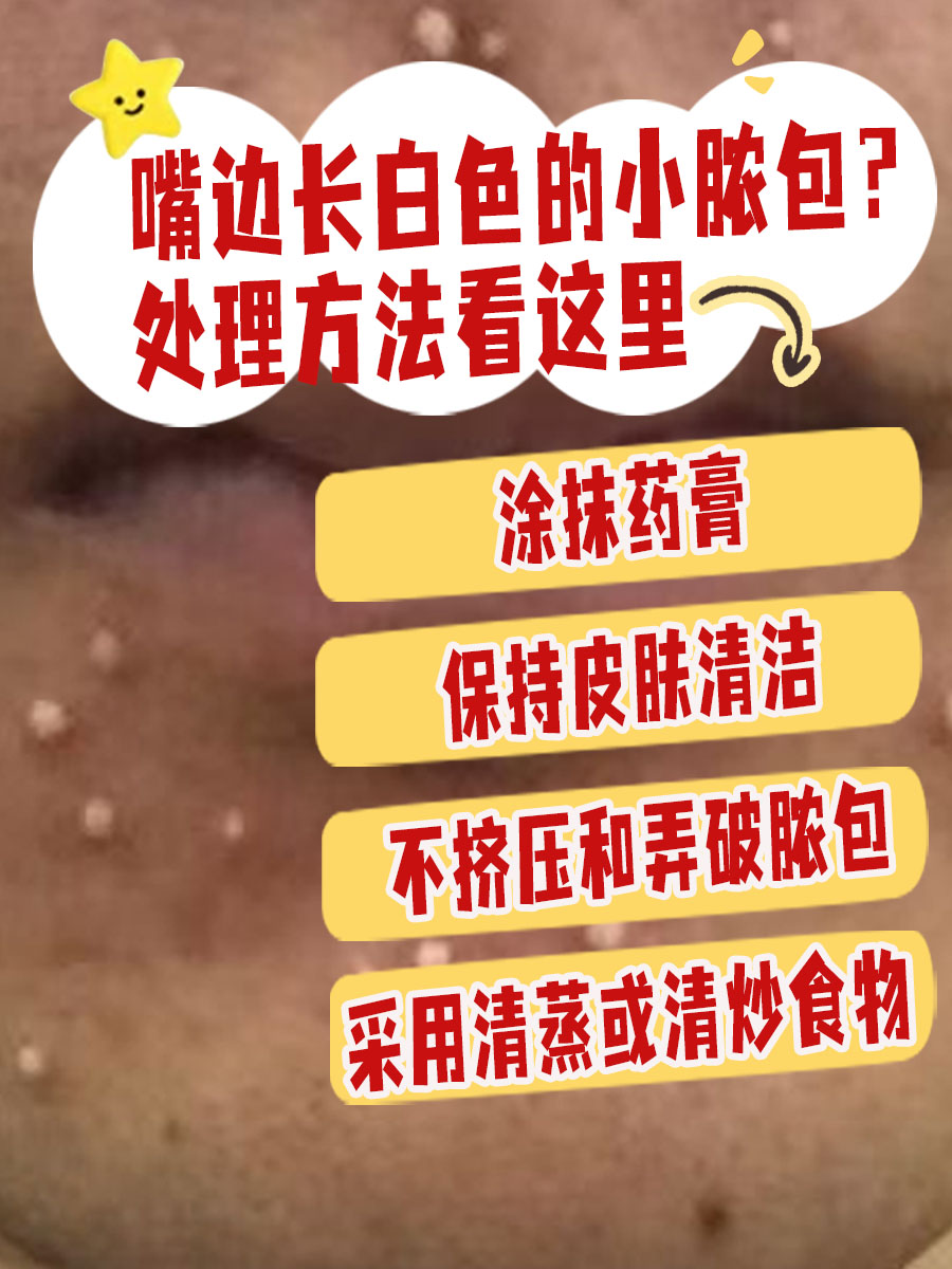 嘴边长白色的小脓包?处理方法看这里