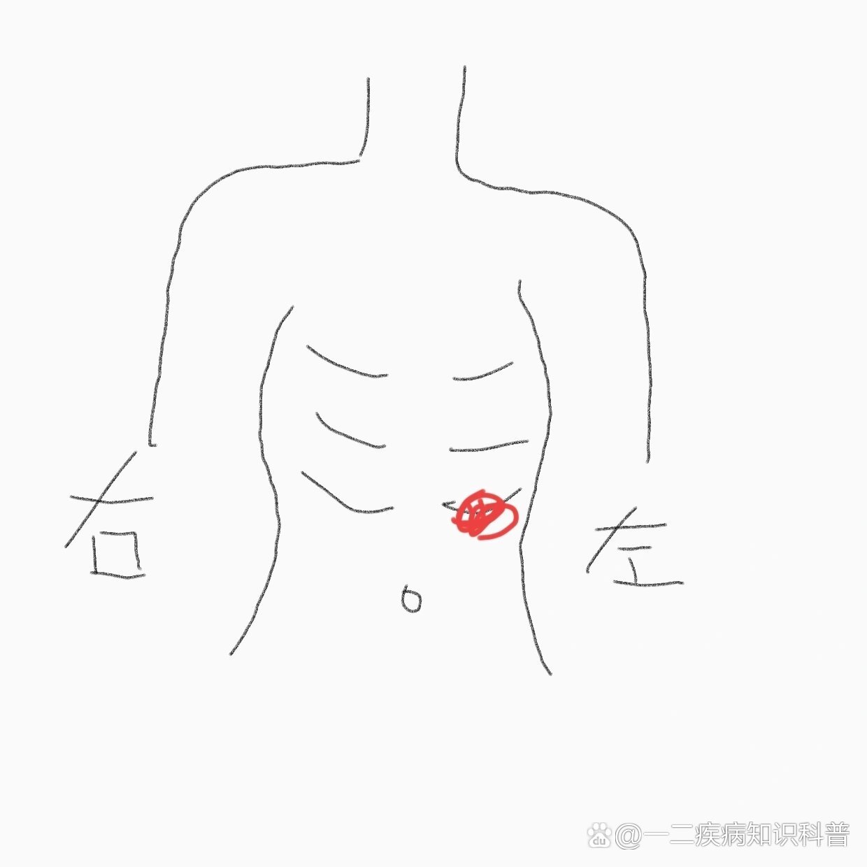 左侧肋骨下缘按压疼