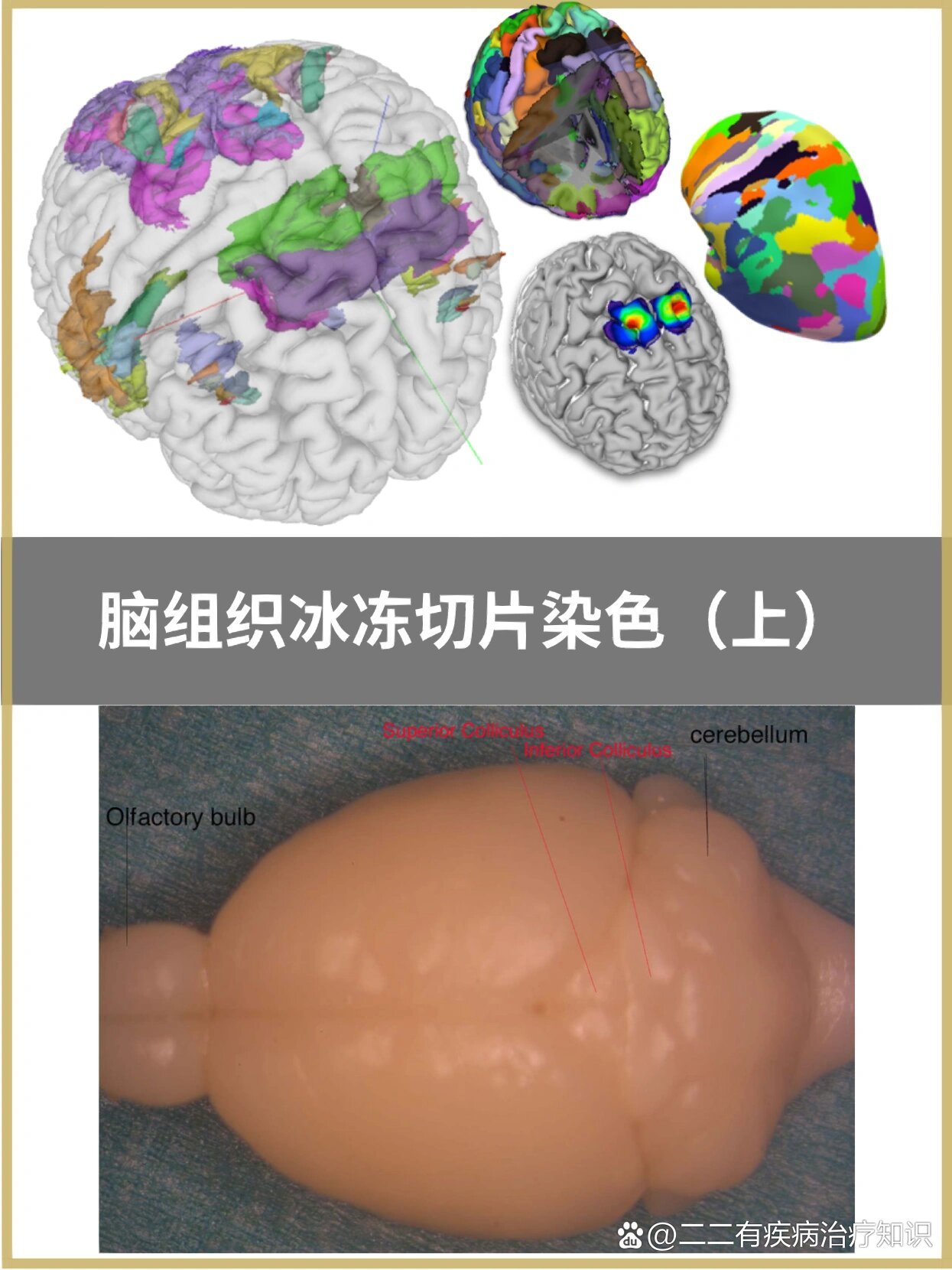 神经切片图片