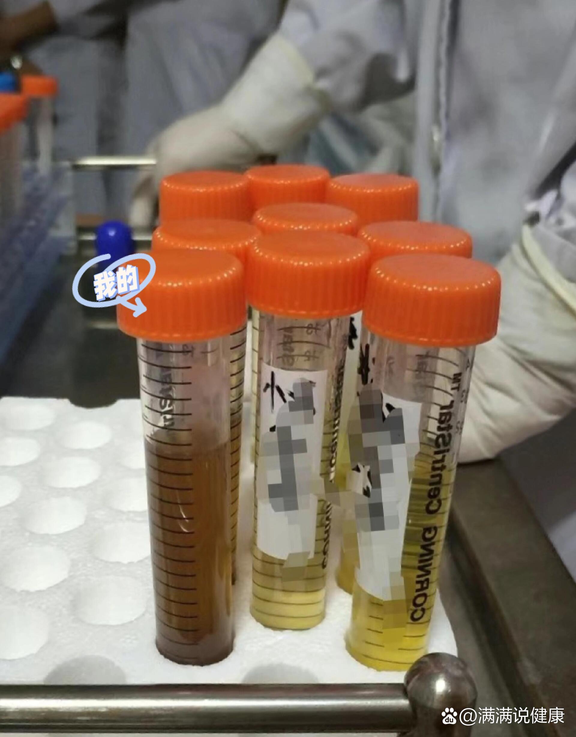 🙋羊穿翻盘之我的褐色羊水