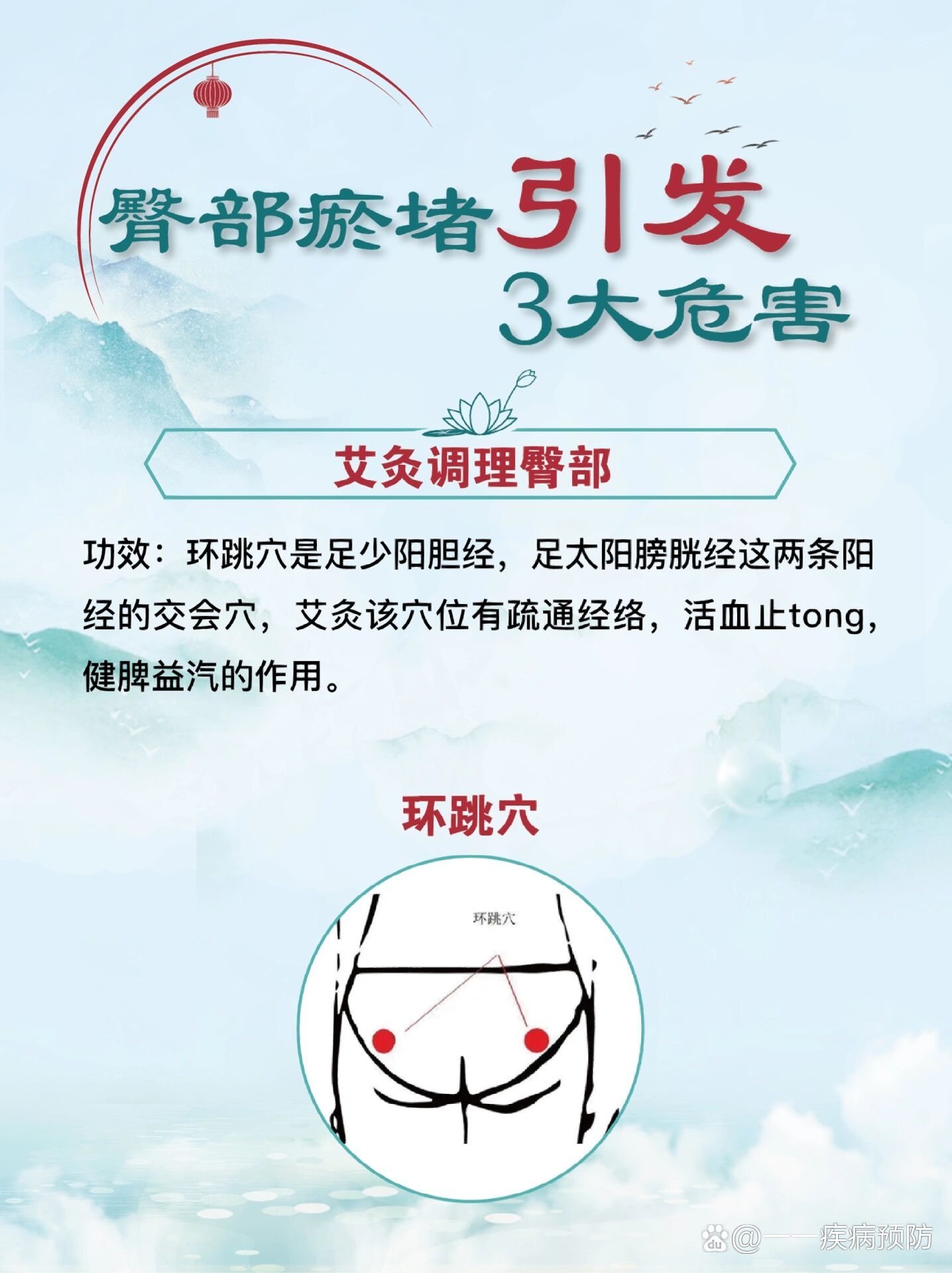臀部瘀堵引发3大危害