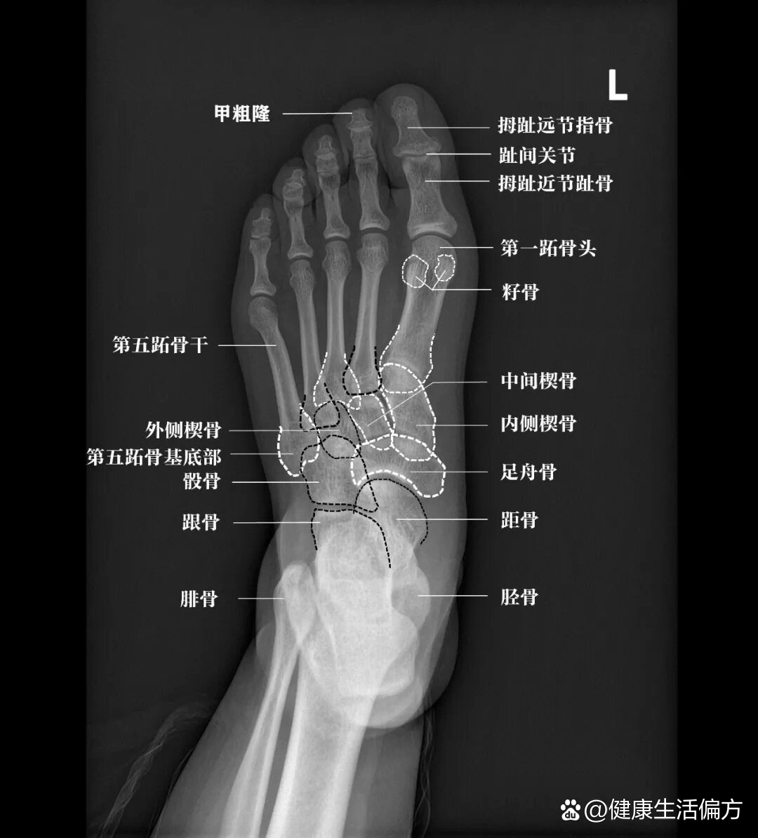 足部x线及解剖图谱