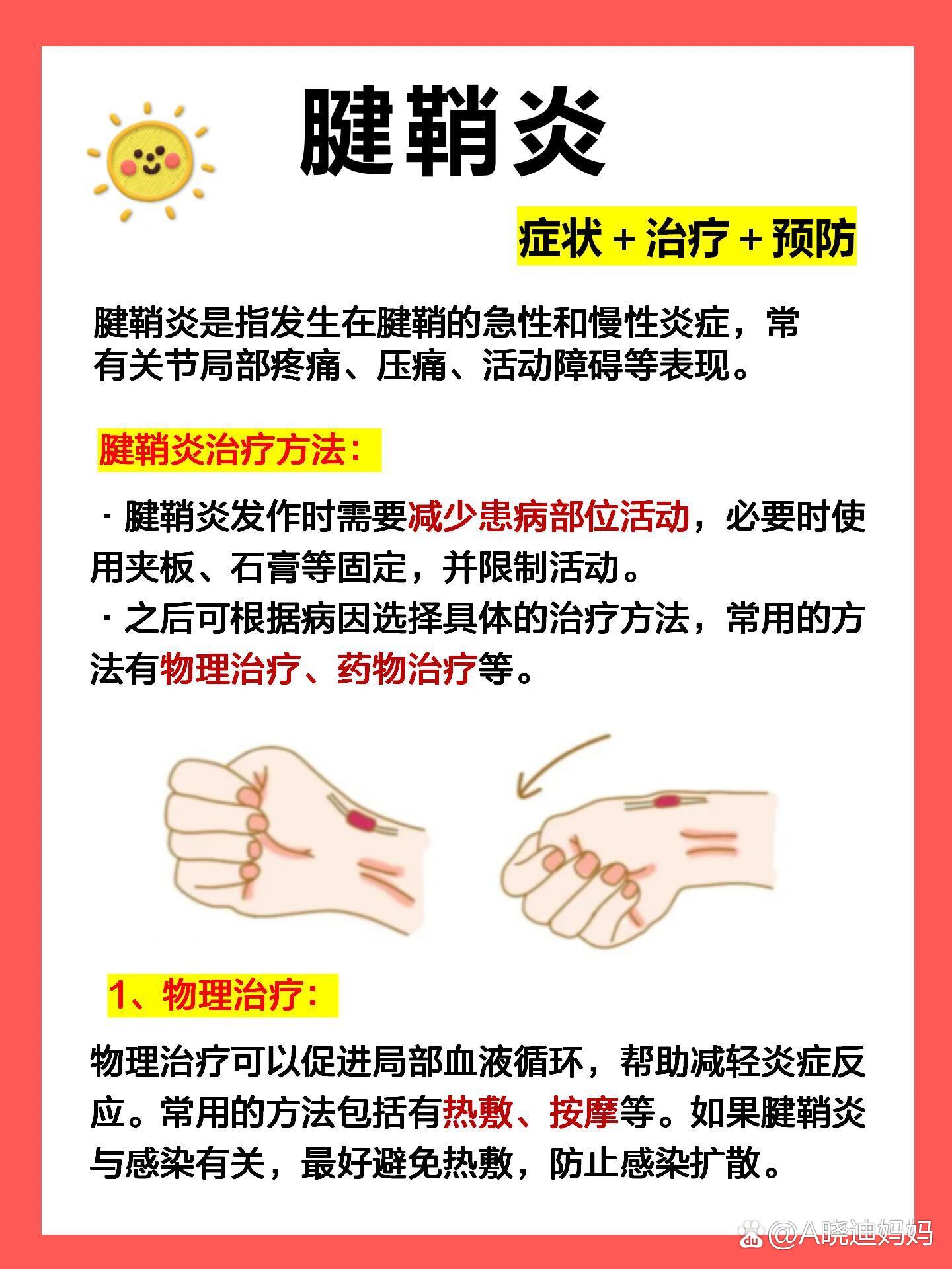 腱鞘炎怎么治疗方法图片