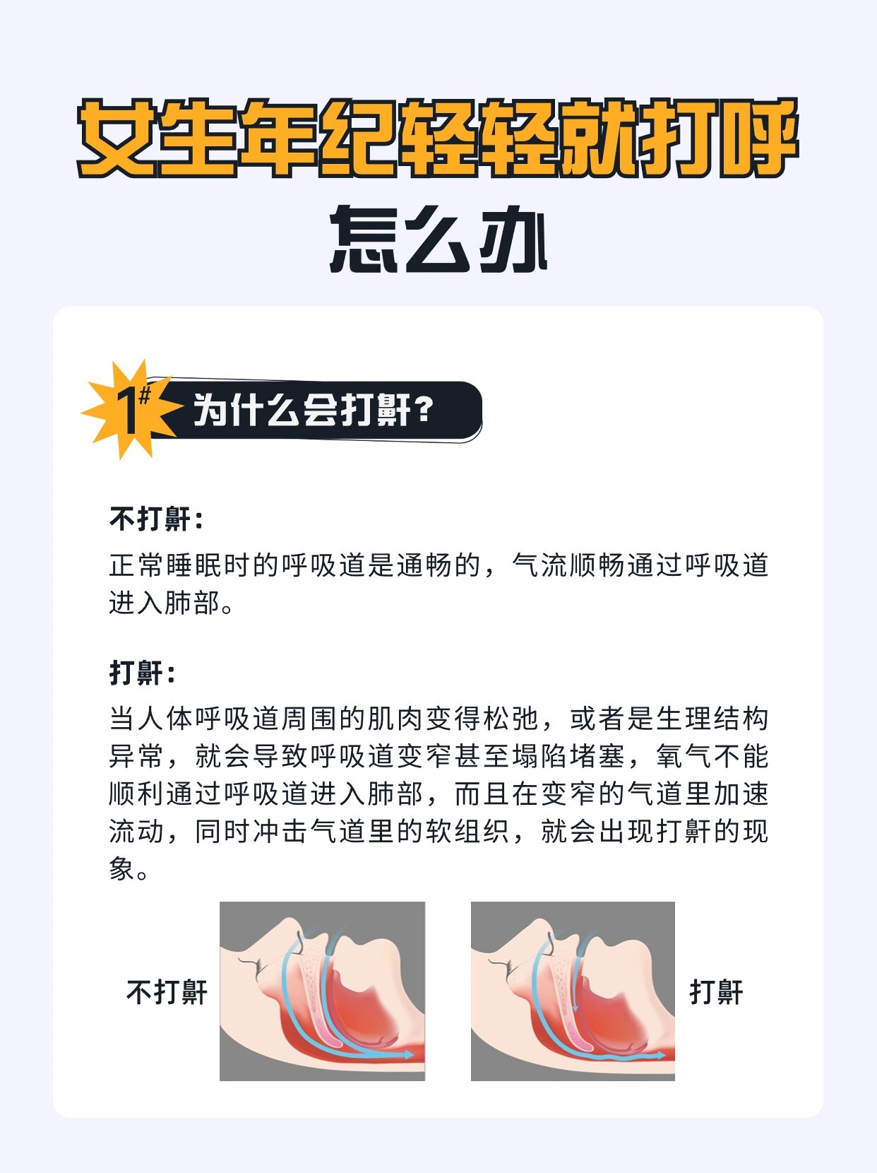 为什么会打呼噜女性打呼噜的原因的简单介绍 为什么会打呼噜女性打呼噜的原因的简单介绍