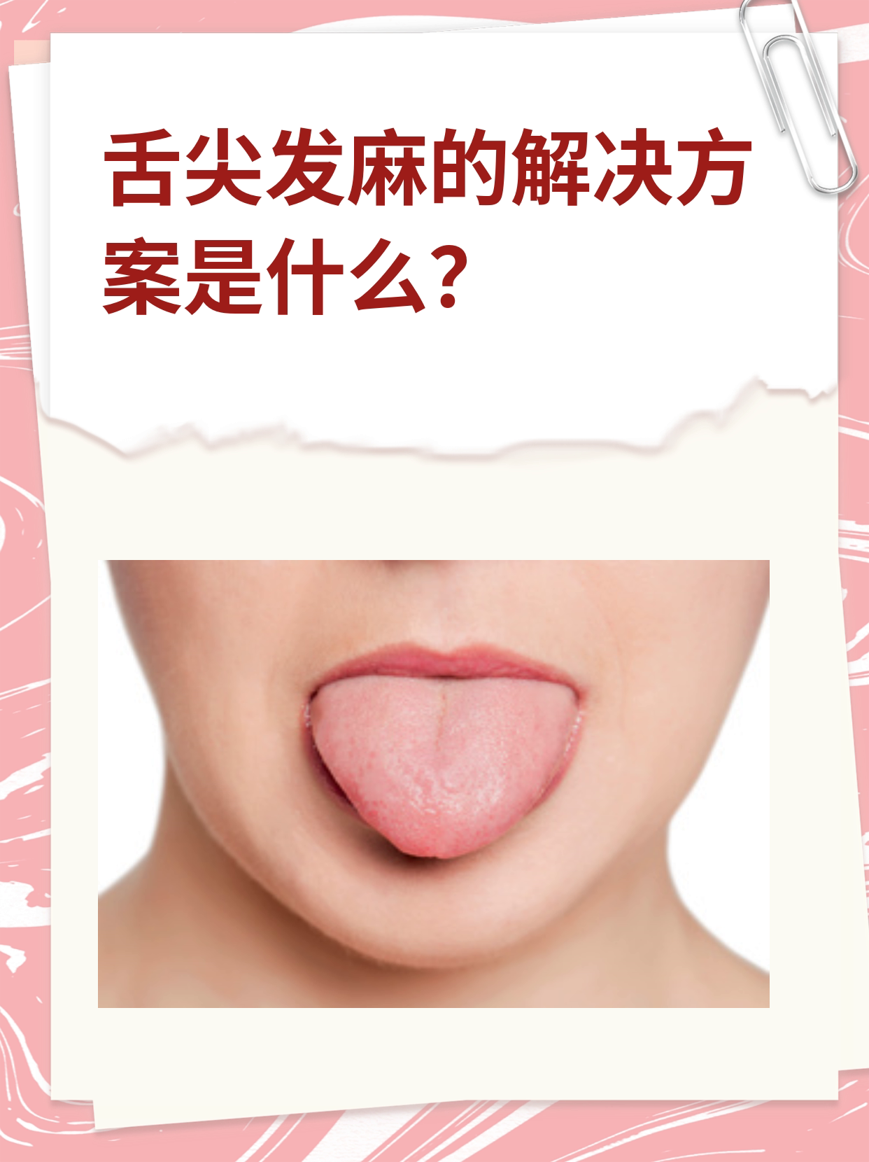  p>"我最近舌头总是感觉麻木09,有时还刺痛.