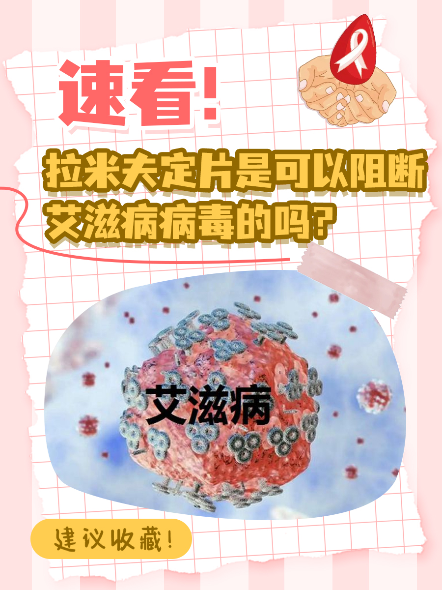速看!拉米夫定片是可以阻断艾滋病病毒的吗?