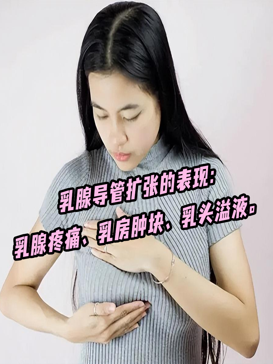 乳腺导管瘤 真人图片