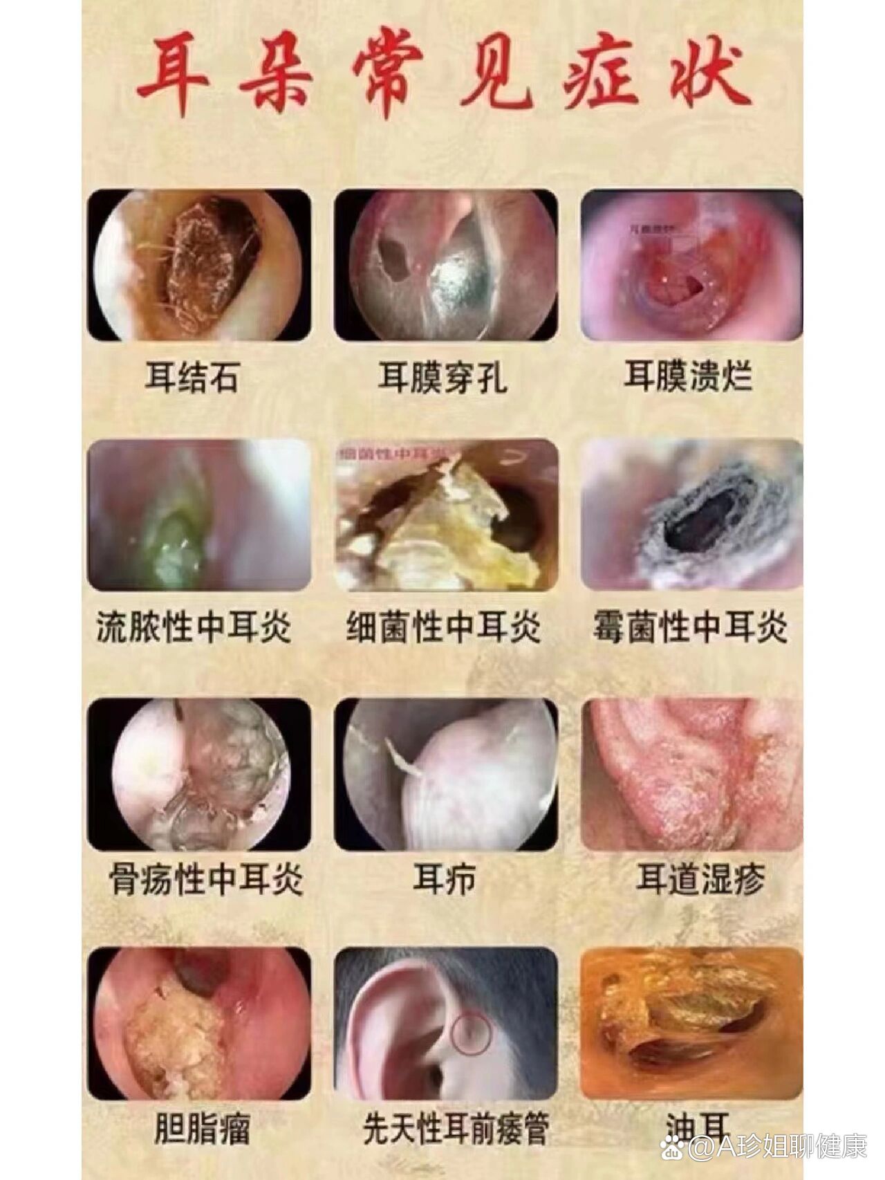 耳朵局部受到细菌或者真菌的刺激,导致出现炎症反应,出现脱皮情况