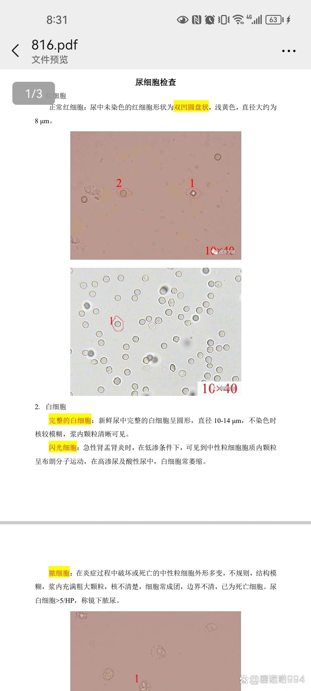 5种白细胞形态绘图图片