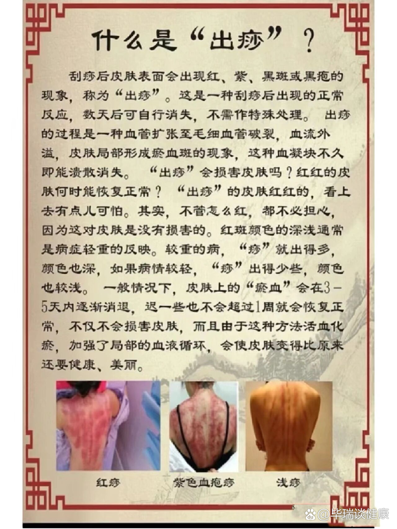 为什么会出痧包百科在线