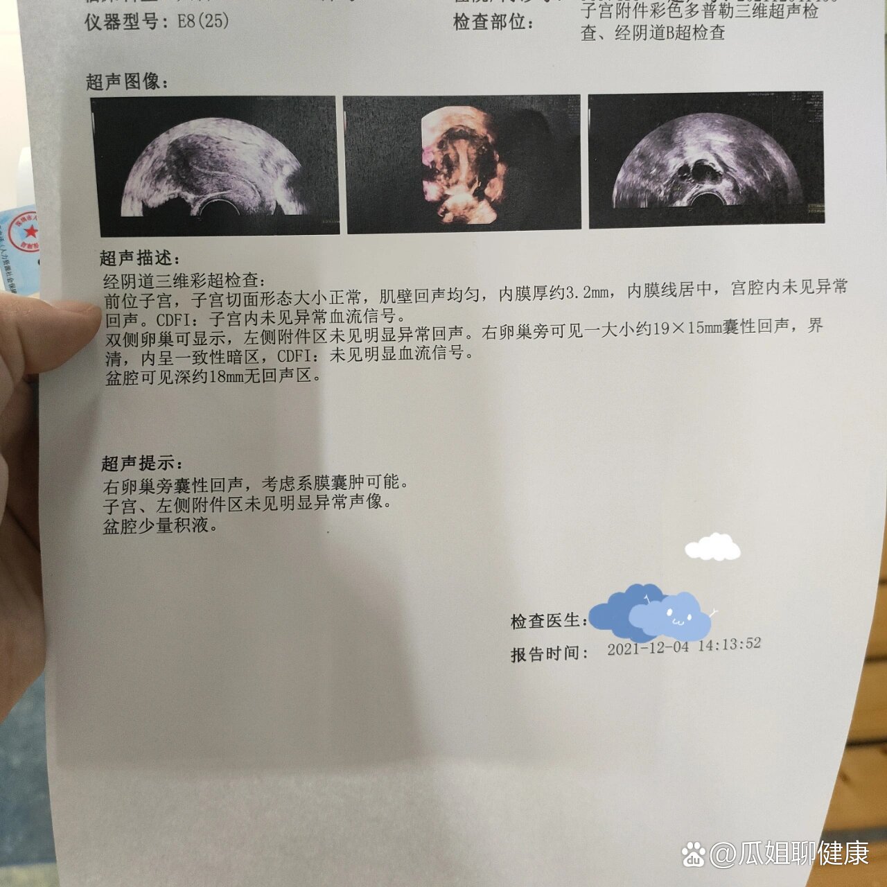 两个月说有积水,这个月复查又说没之前都没有发现过输卵管积液,8