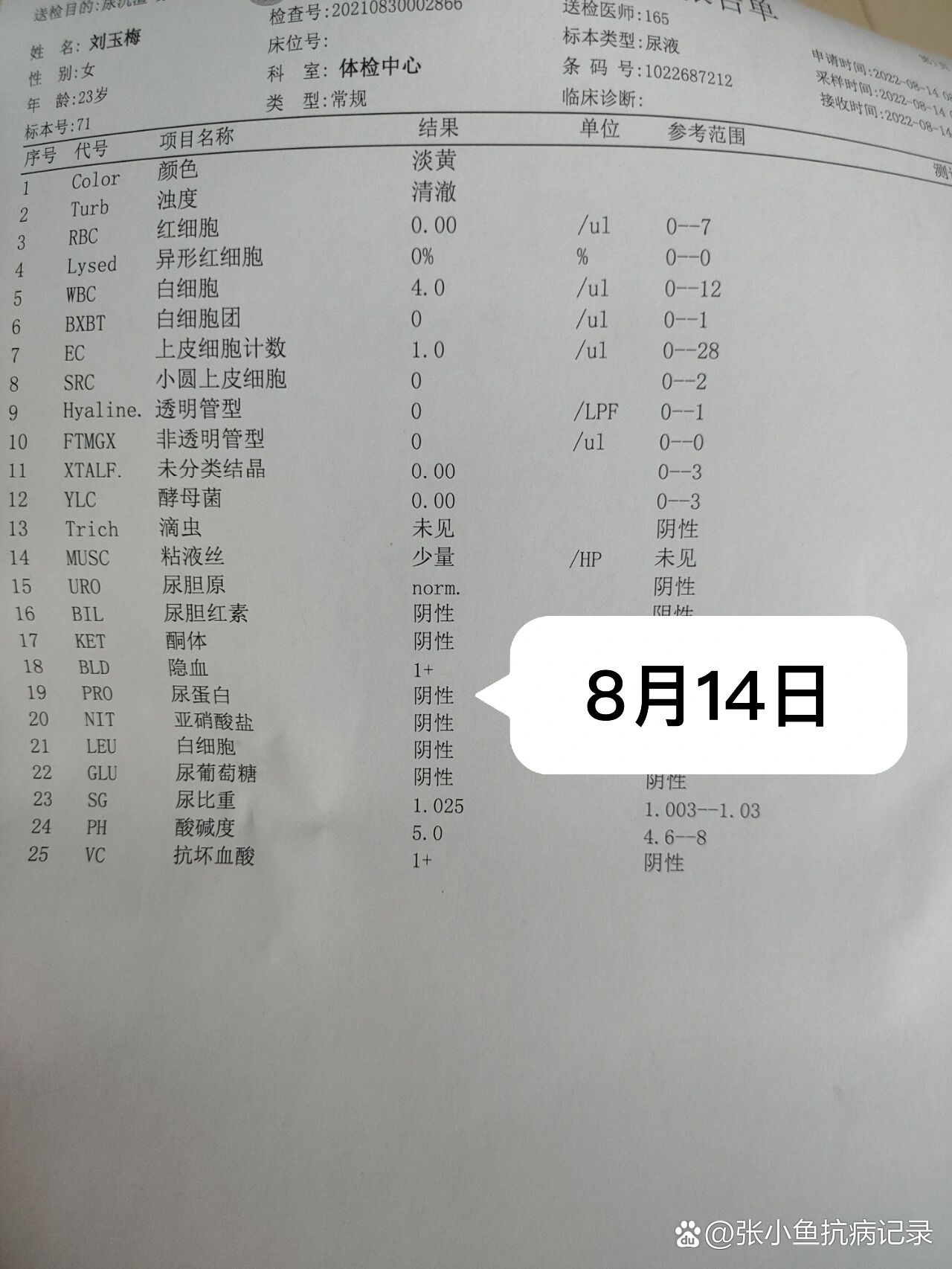 尿蛋白阳性图片