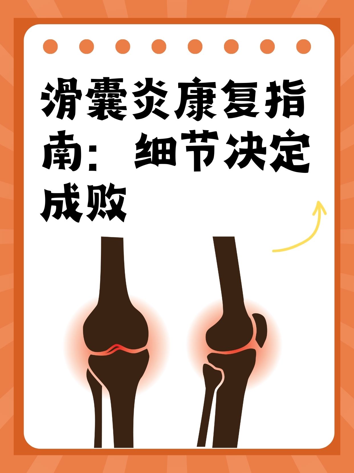 滑囊炎患者福音:最佳治疗方法大揭秘