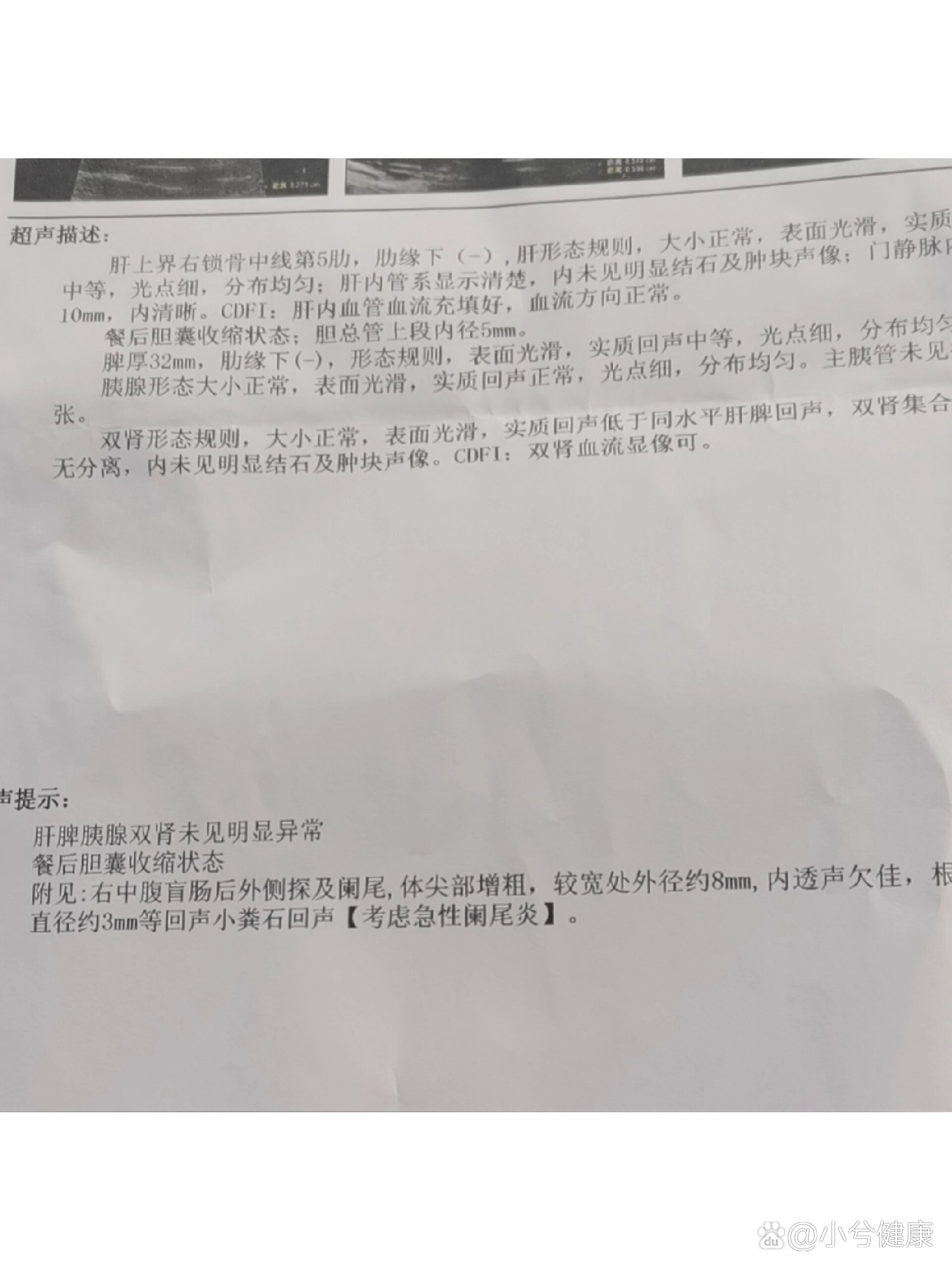 阑尾炎做什么检查图片