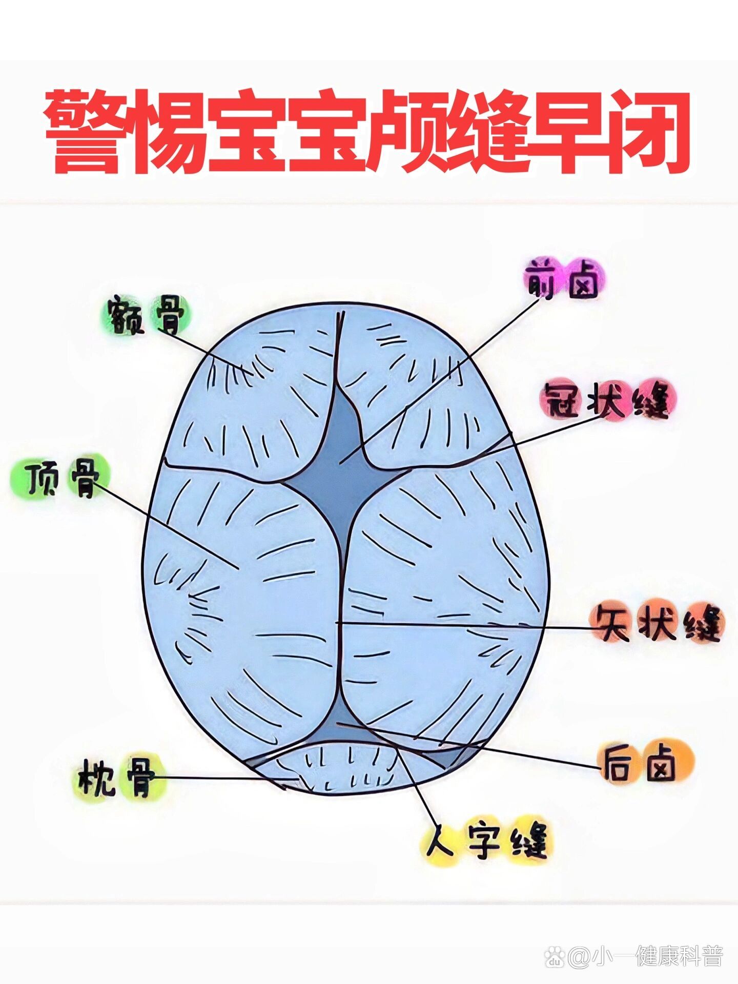 颅骨骨缝分离图片图片