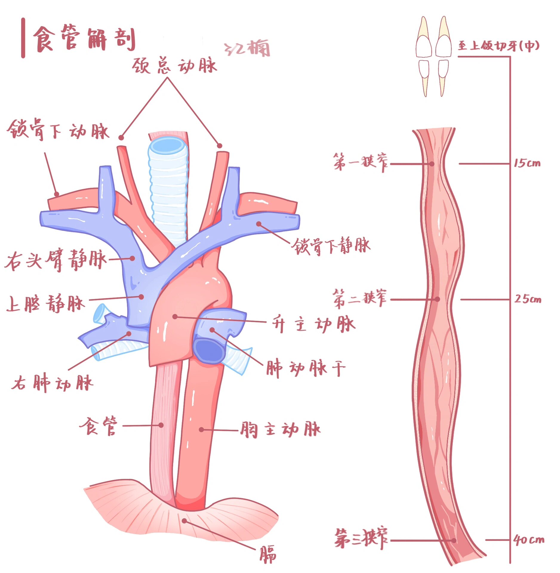 食管的第二个狭窄图片