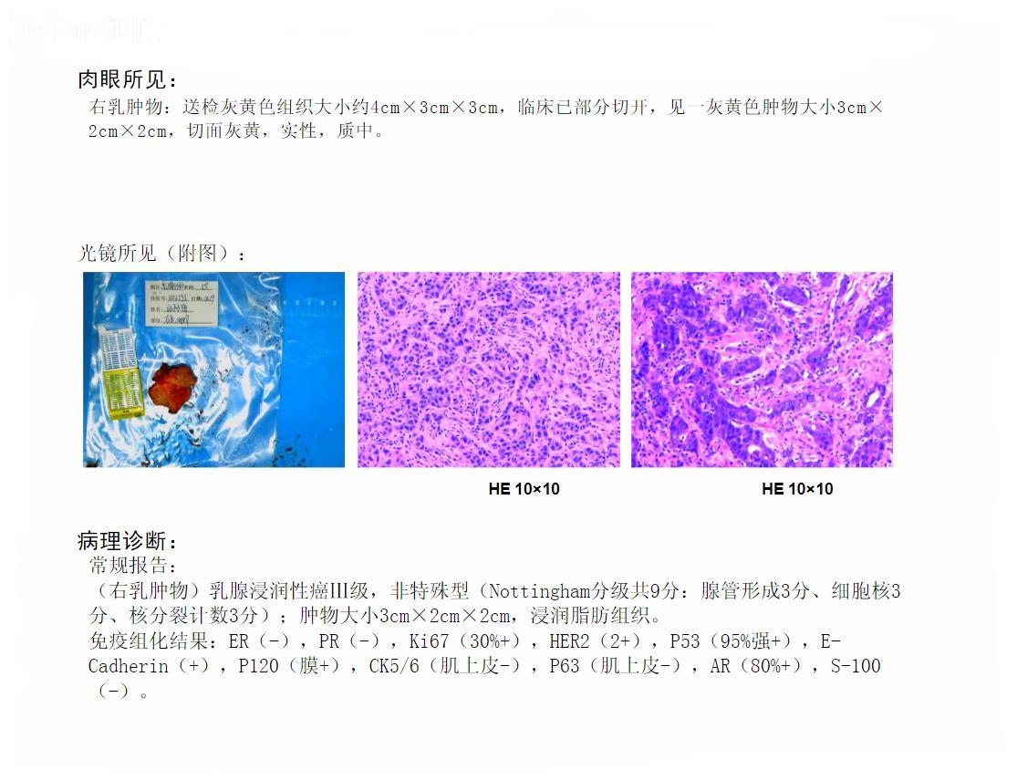 包含北京大学肿瘤医院号贩子挂号代诊-交给我们你放心，让每一位患者达到满意的词条