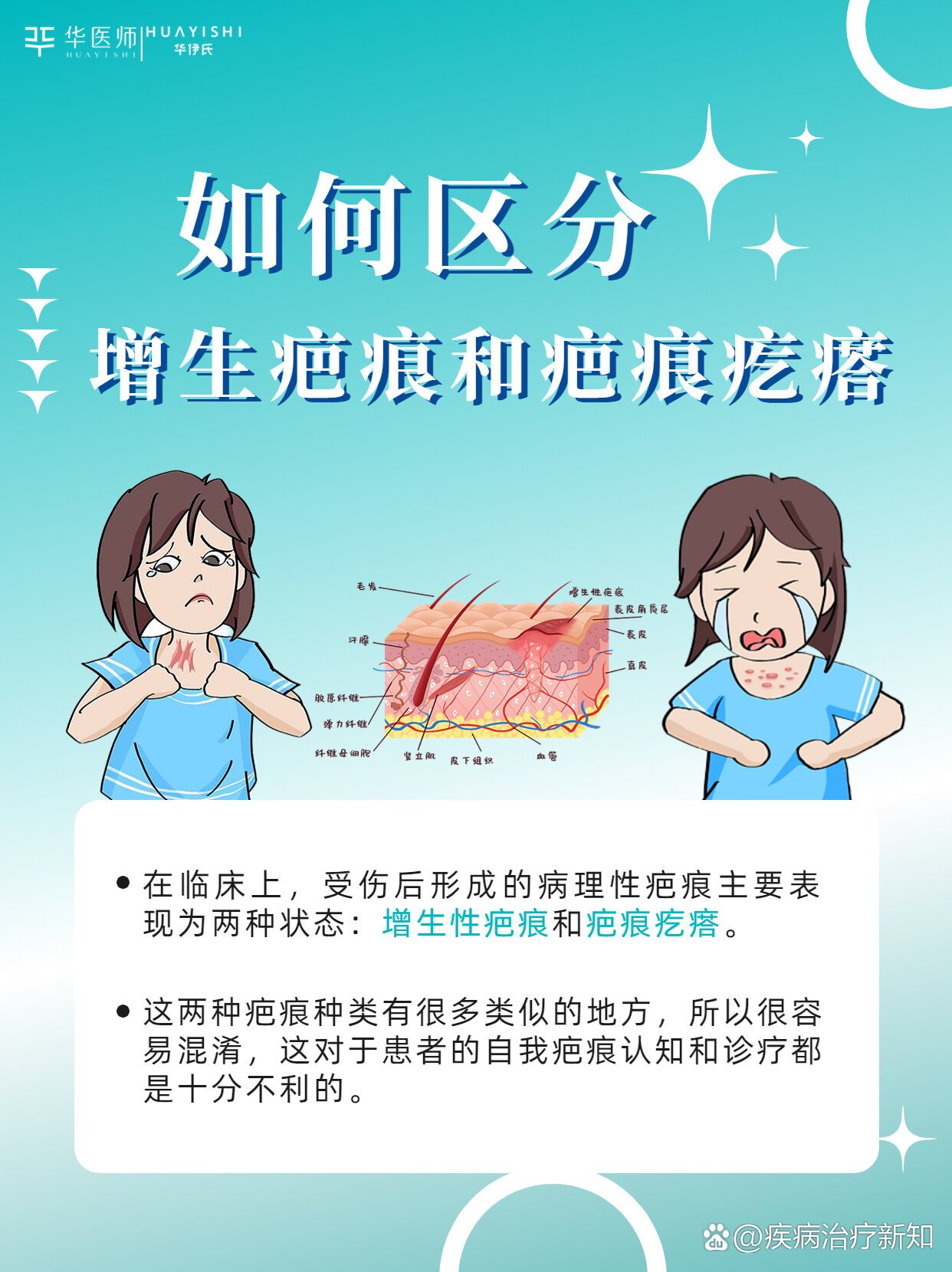 增生疤痕vs疤痕疙瘩|如何正确区分?