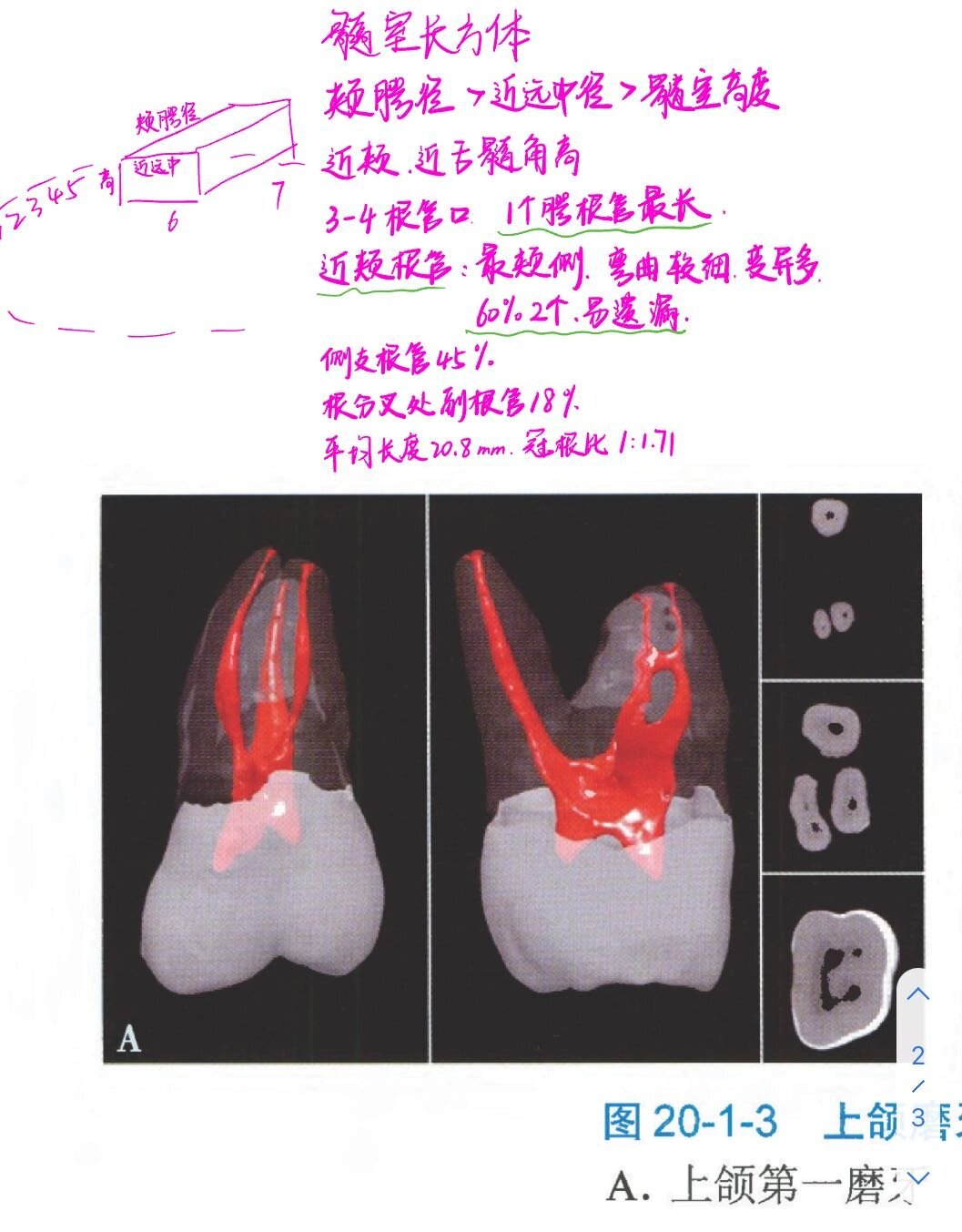 下颌中切牙髓腔形态图片