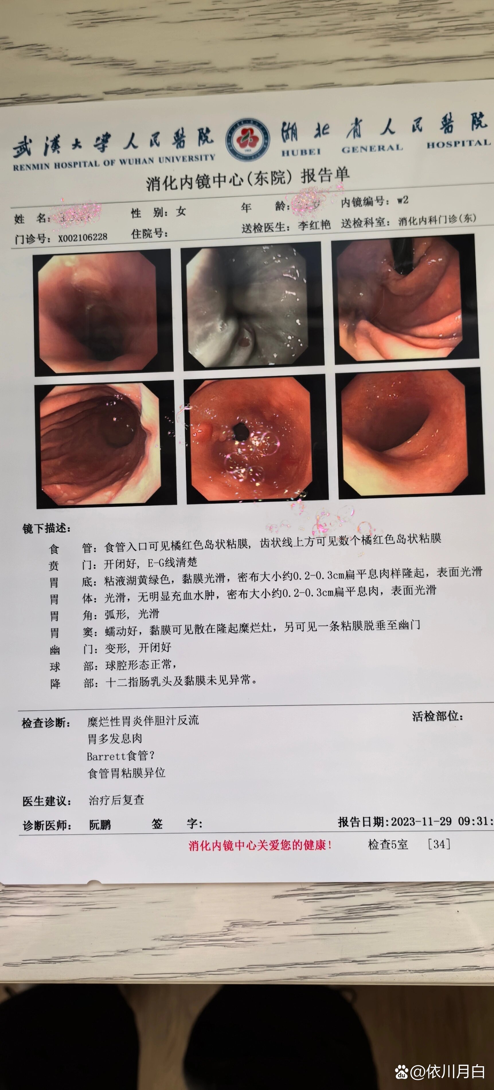 胃息肉切除需要一万吗