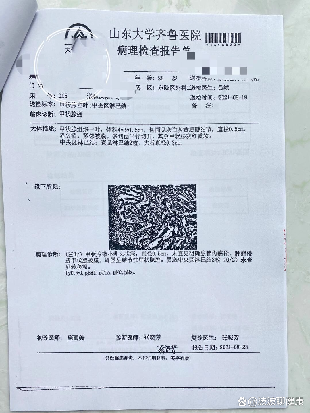 甲状腺乳头状癌术后大病理报告