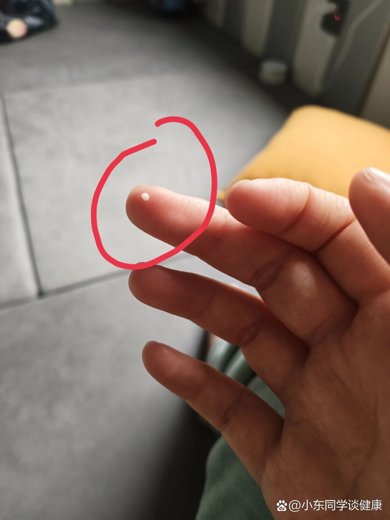 宝宝眼睛里总有这种白色眼屎是怎么回事呢