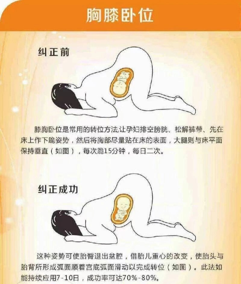 早晨子宫后位指导分享