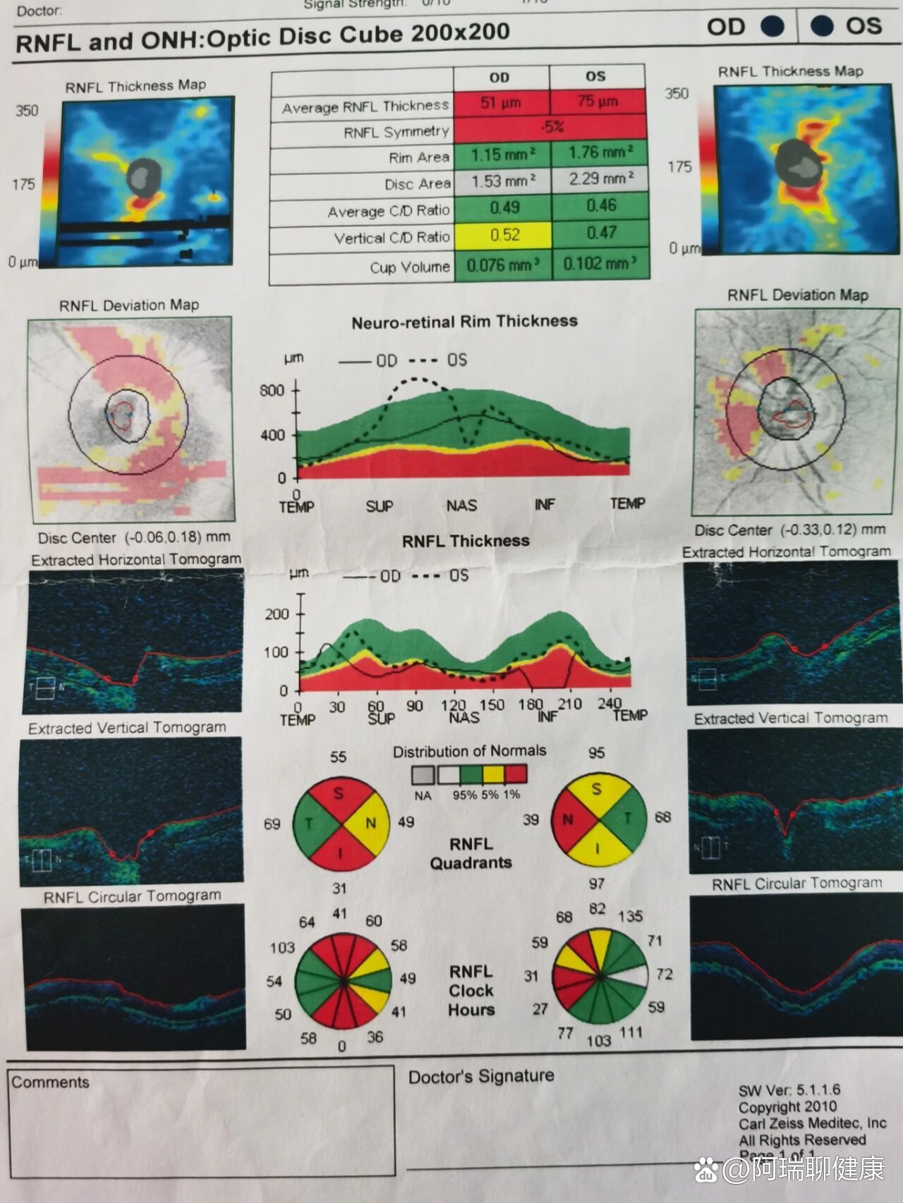 眼科oct检查报告