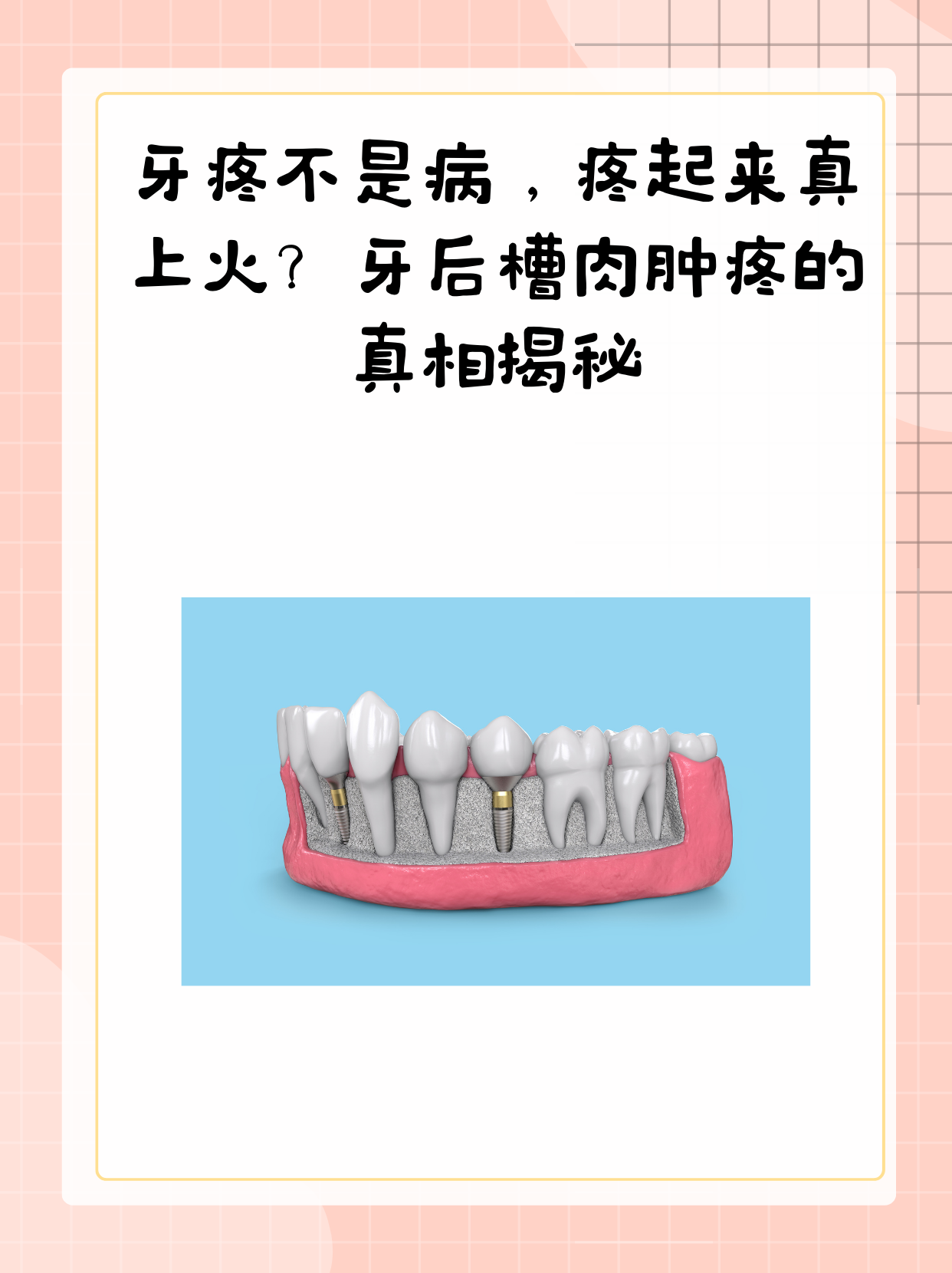 牙后槽肉肿疼