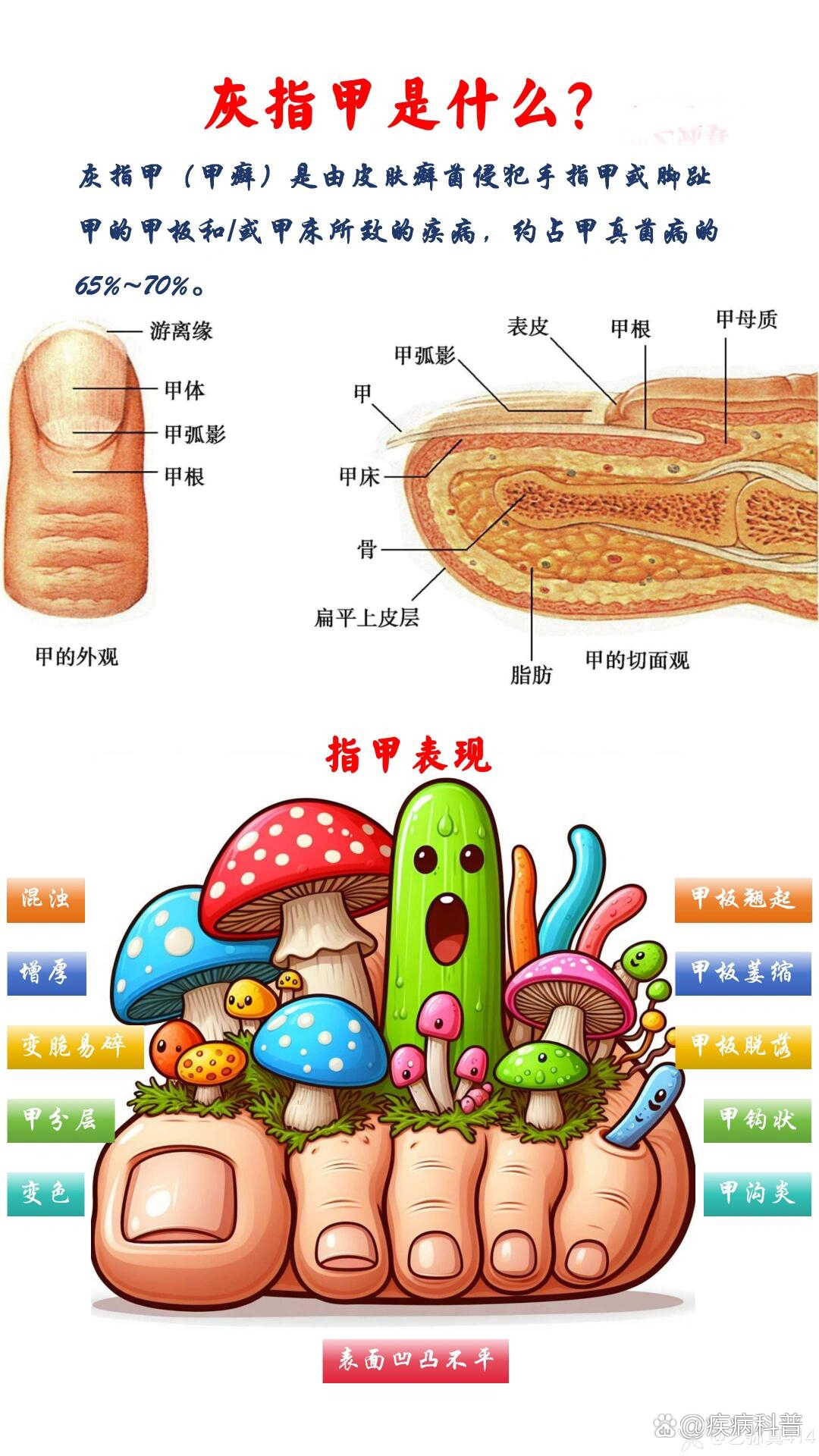 指甲的甲母示意图图片