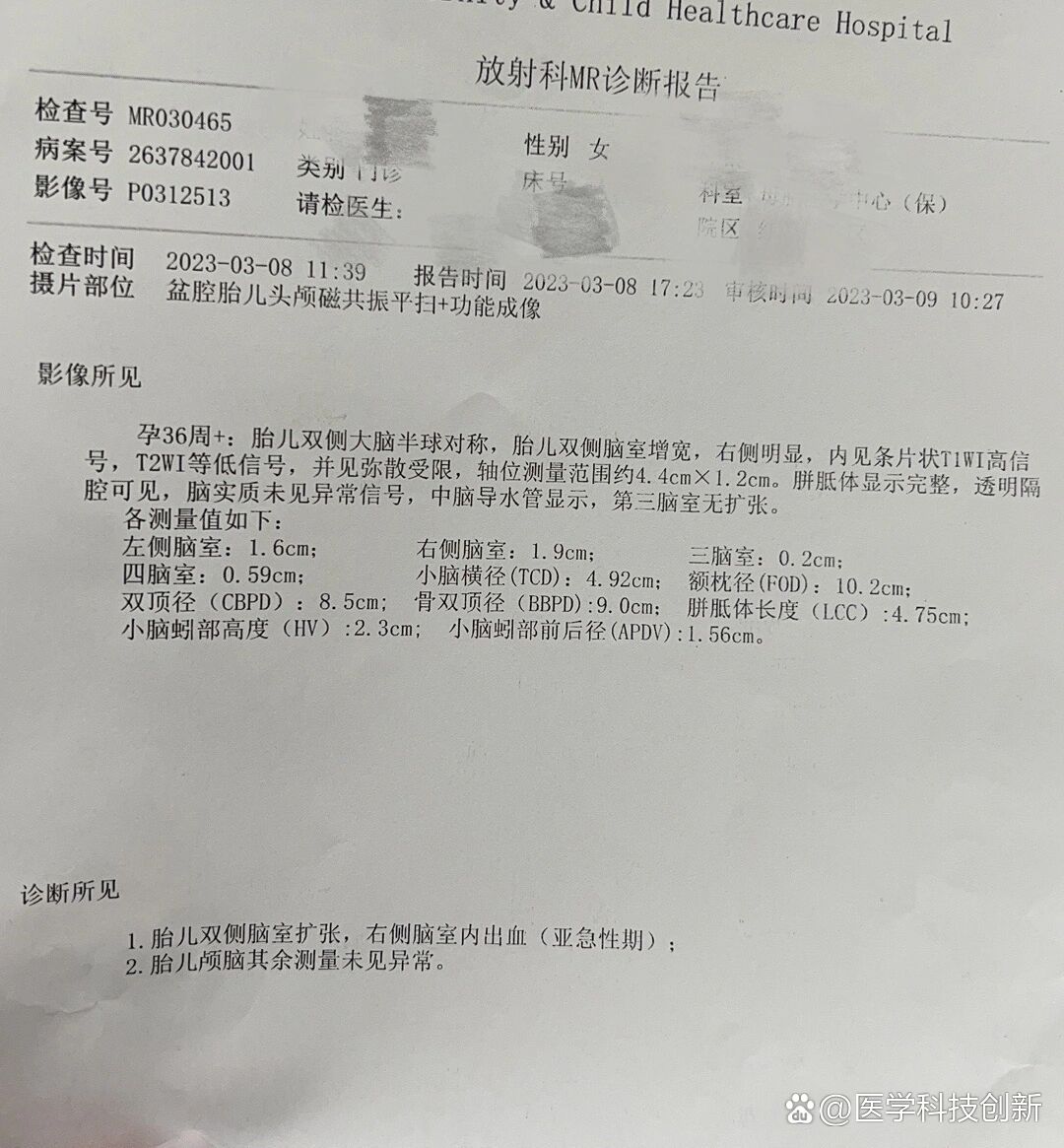  p>刚拿了头颅脑磁共振的结果 br>今下午拿着核磁共振片子找到了超声
