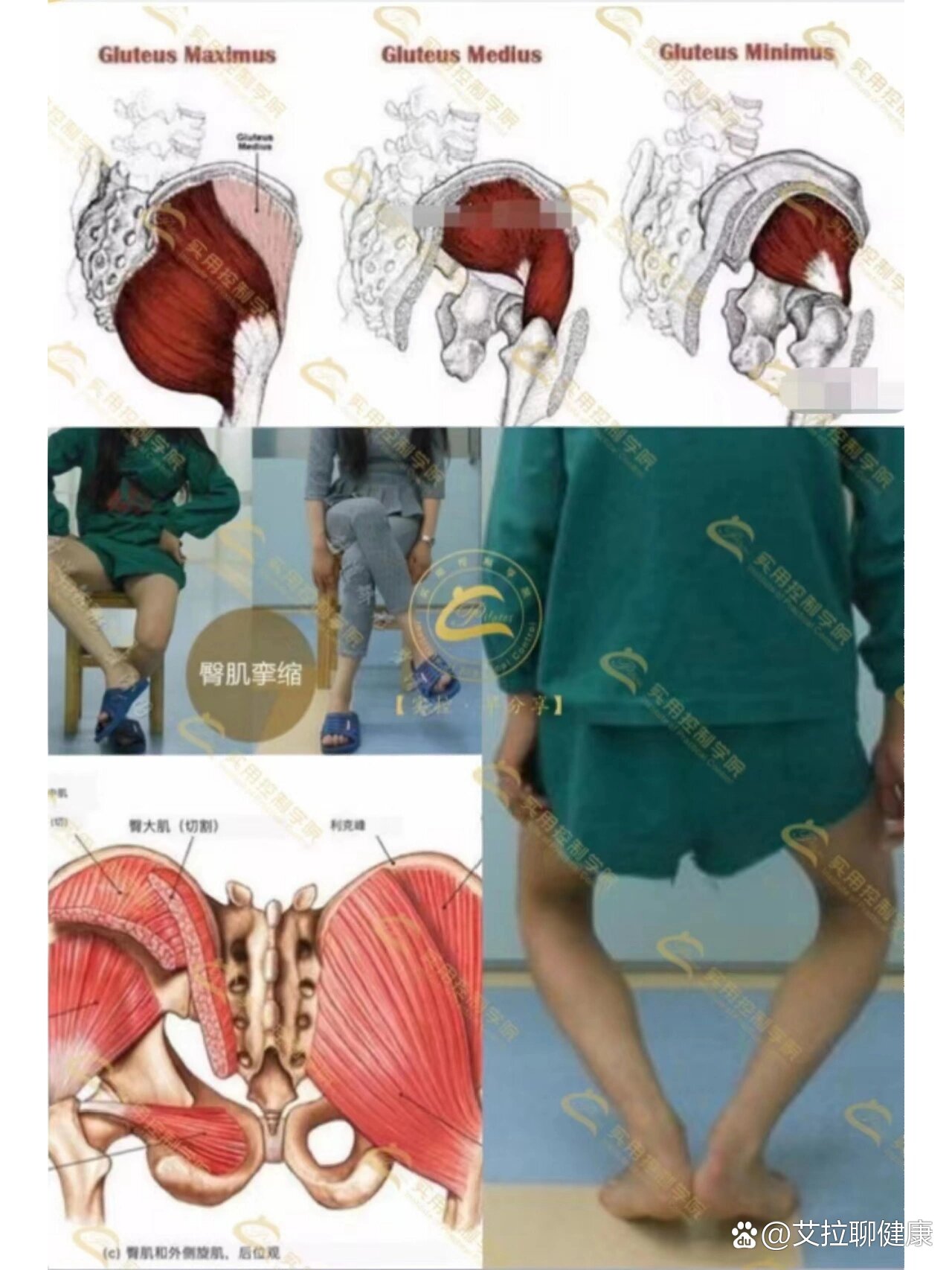 小知识分享之臀肌挛缩"臀肌挛缩综合症"主要诱因是频繁臀部